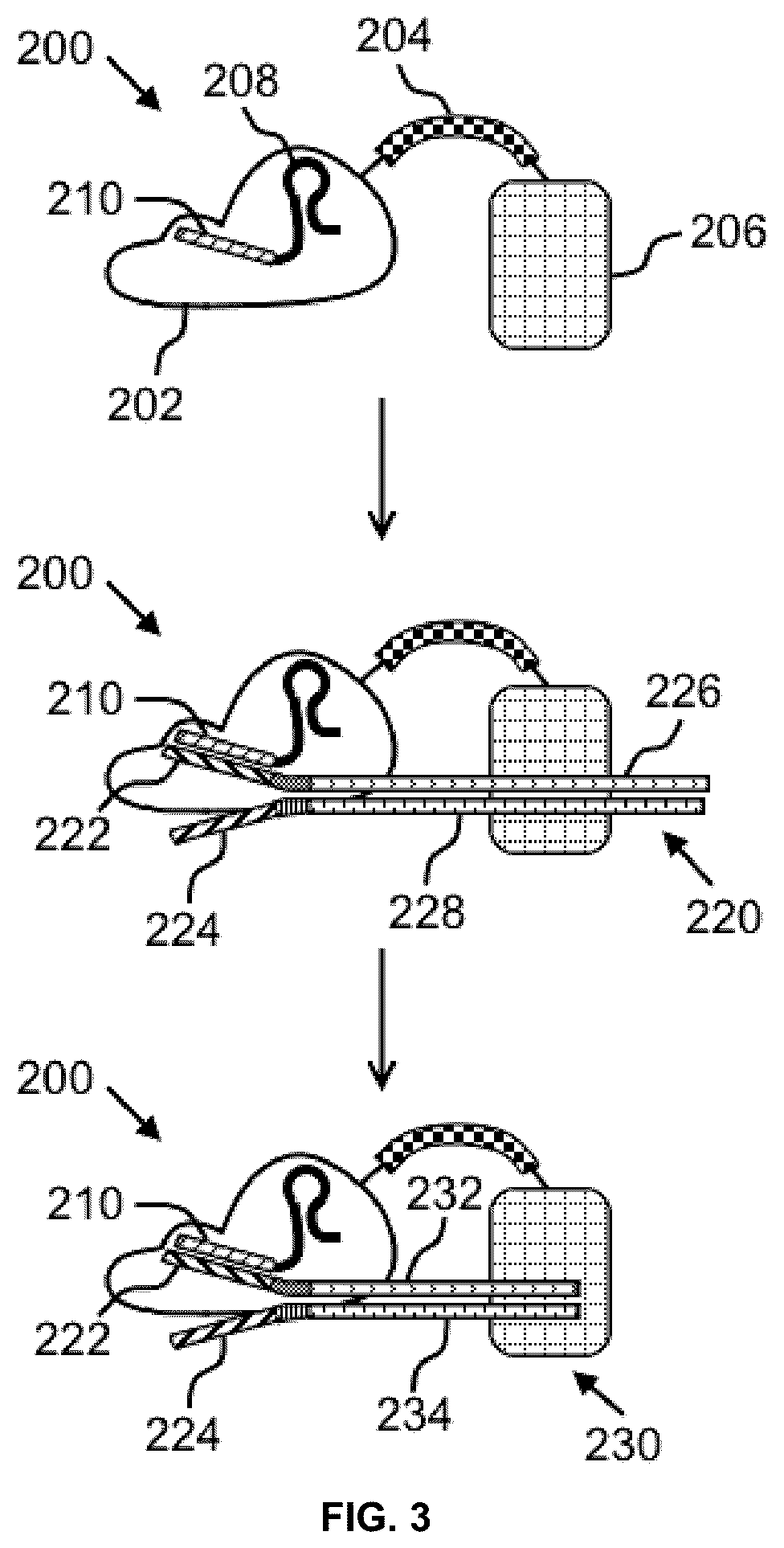 Patent US12365893 Figure 3 – Systems and methods for nucleic acid preparation