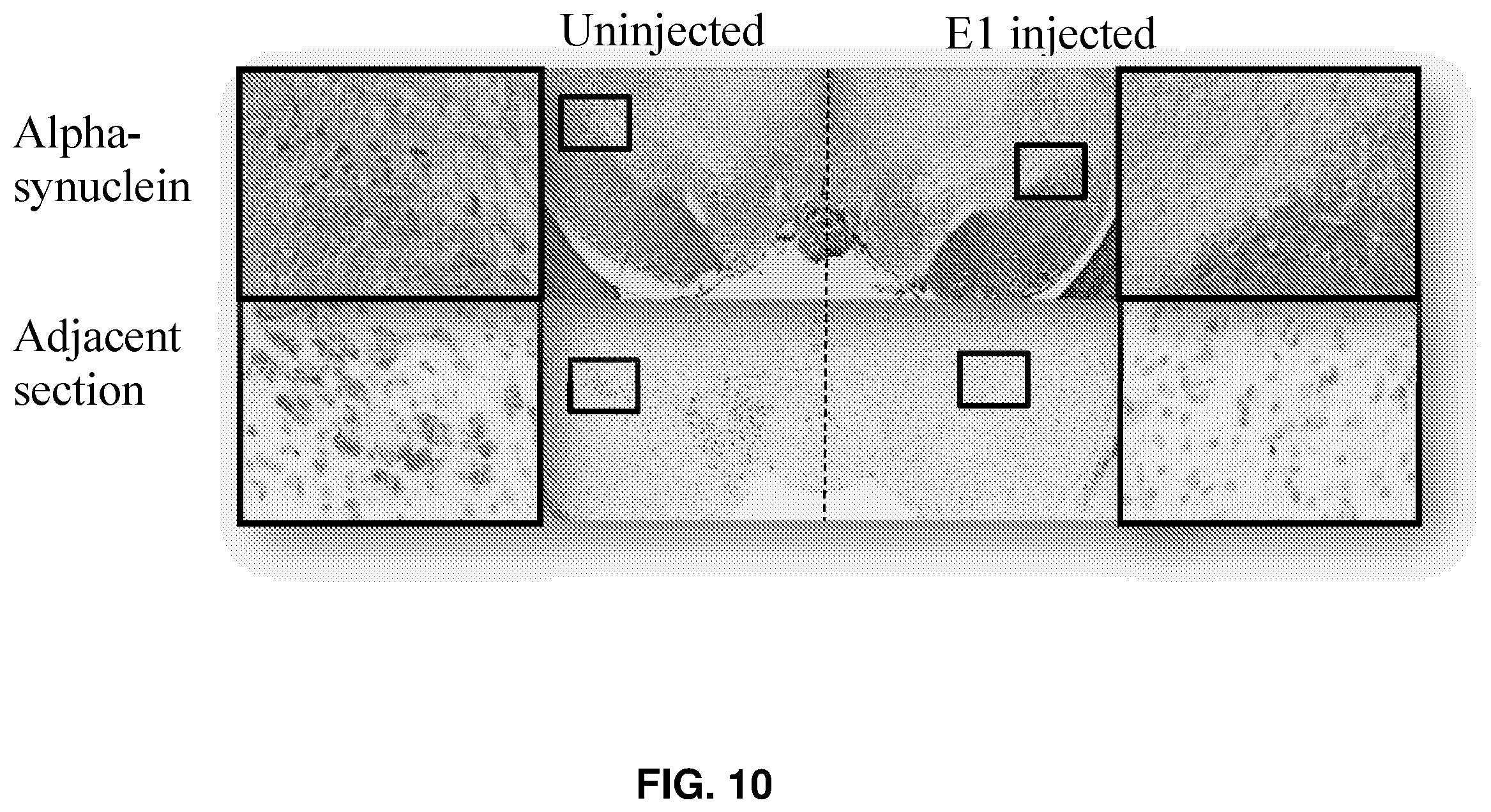 Patent US12365895 Figure 10 – Variant RNAi against alpha-synuclein