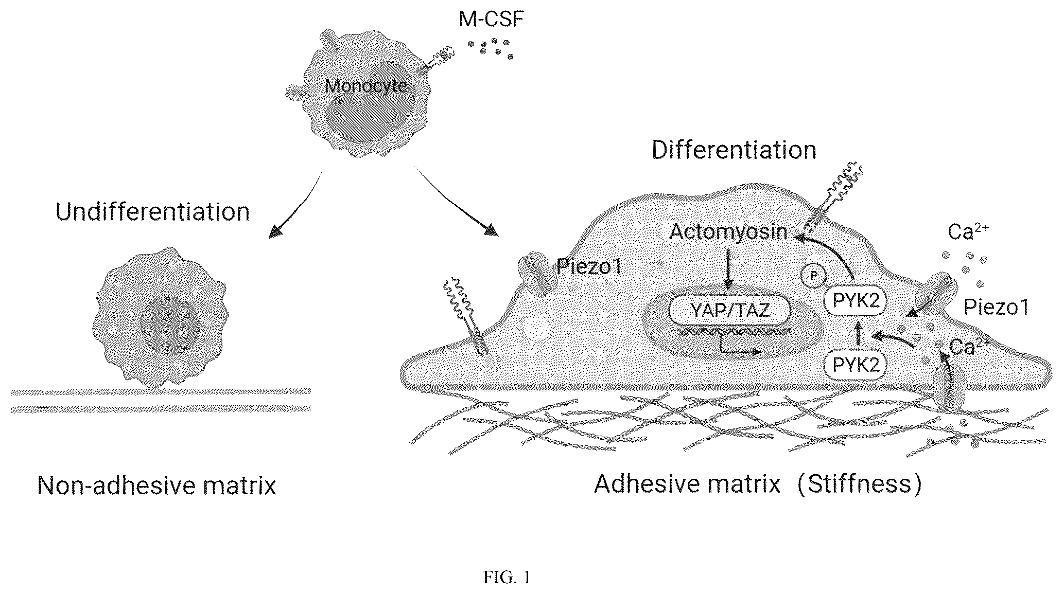 Patent US12365901 Figure 1 – Application of mechanical-force sensitive macrophage subset in pancreatic cancer diagnosis or prognosis evaluation