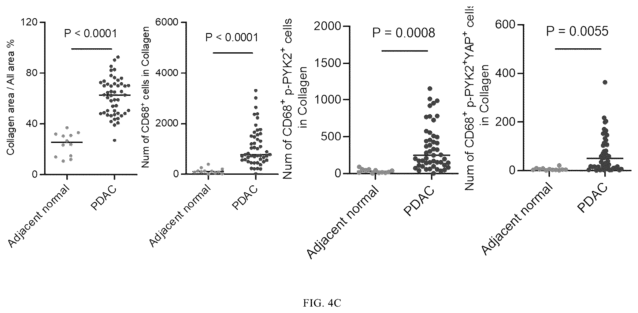 Patent US12365901 Figure 8 – Application of mechanical-force sensitive macrophage subset in pancreatic cancer diagnosis or prognosis evaluation