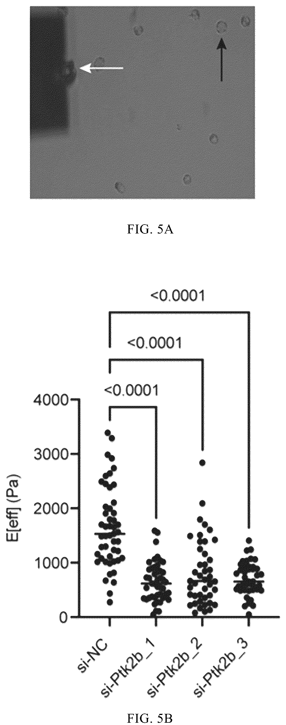 Patent US12365901 Figure 10 – Application of mechanical-force sensitive macrophage subset in pancreatic cancer diagnosis or prognosis evaluation