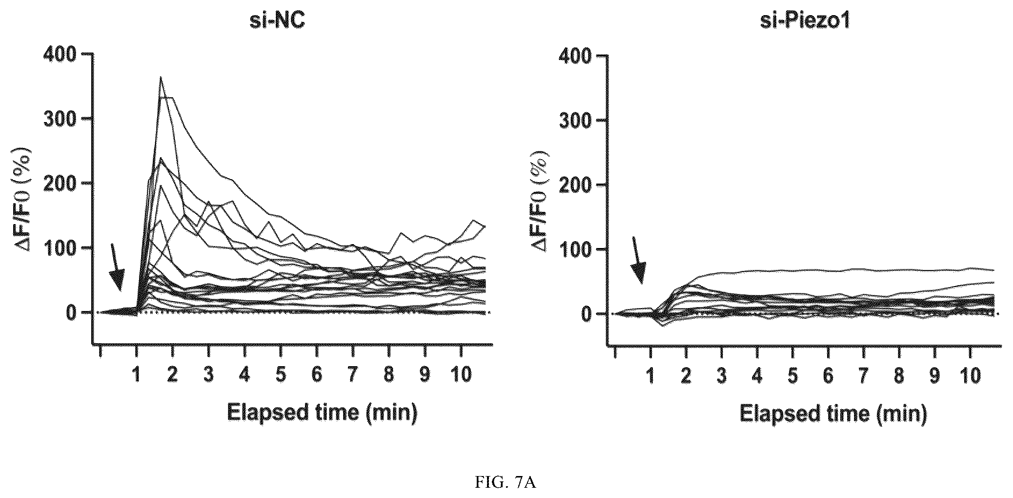 Patent US12365901 Figure 13 – Application of mechanical-force sensitive macrophage subset in pancreatic cancer diagnosis or prognosis evaluation