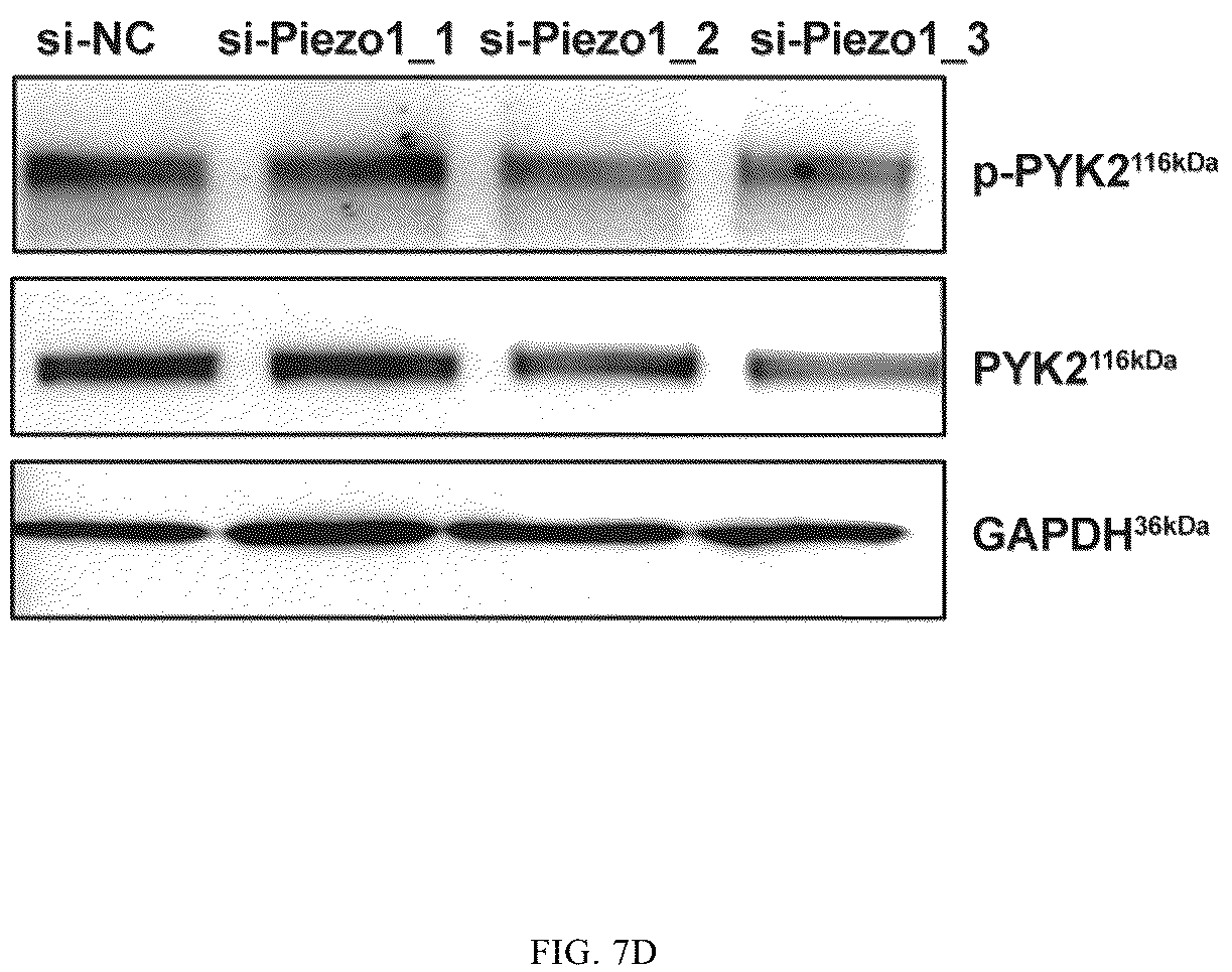 Patent US12365901 Figure 16 – Application of mechanical-force sensitive macrophage subset in pancreatic cancer diagnosis or prognosis evaluation
