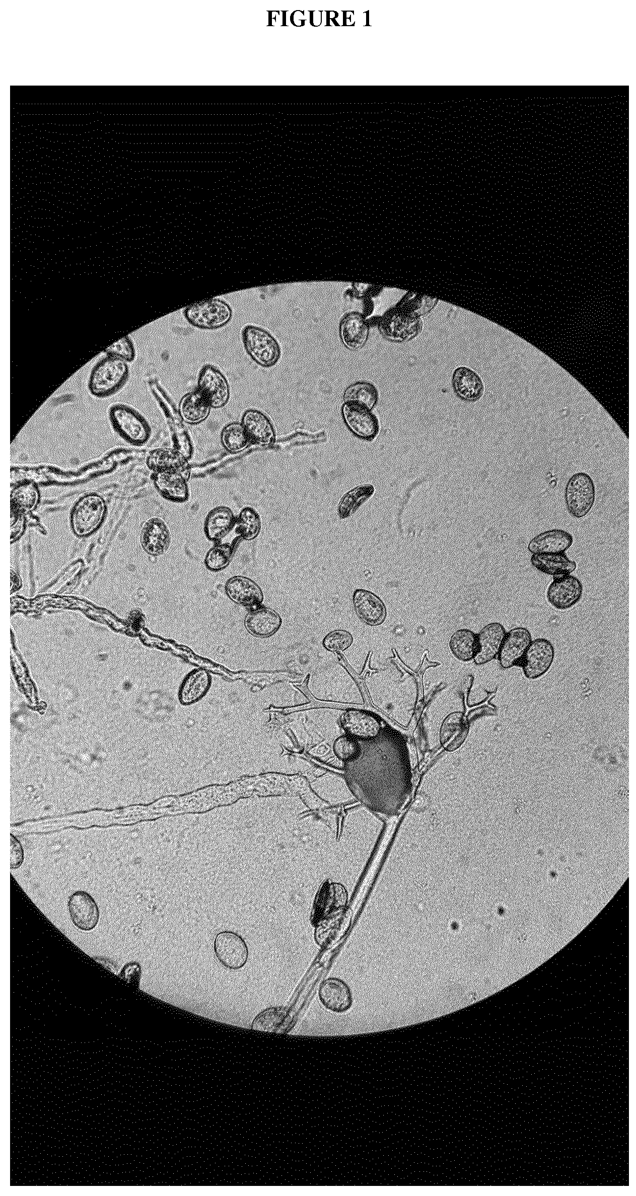 Patent US12365913 Figure 1 – Downy mildew resistant spinach plant