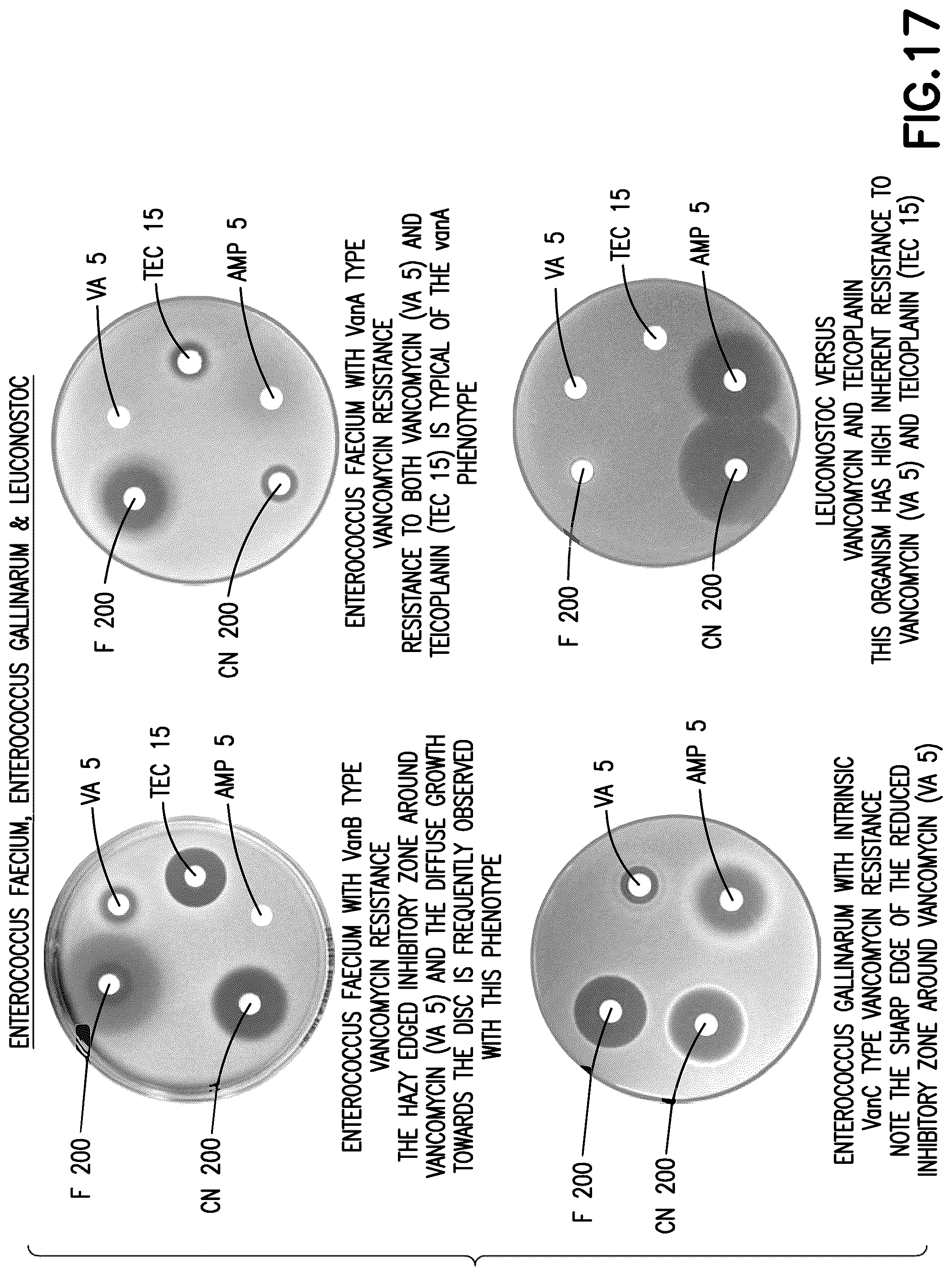 Patent US12365932 Figure 11 – Methods and systems for automated assessment of antibiotic sensitivity