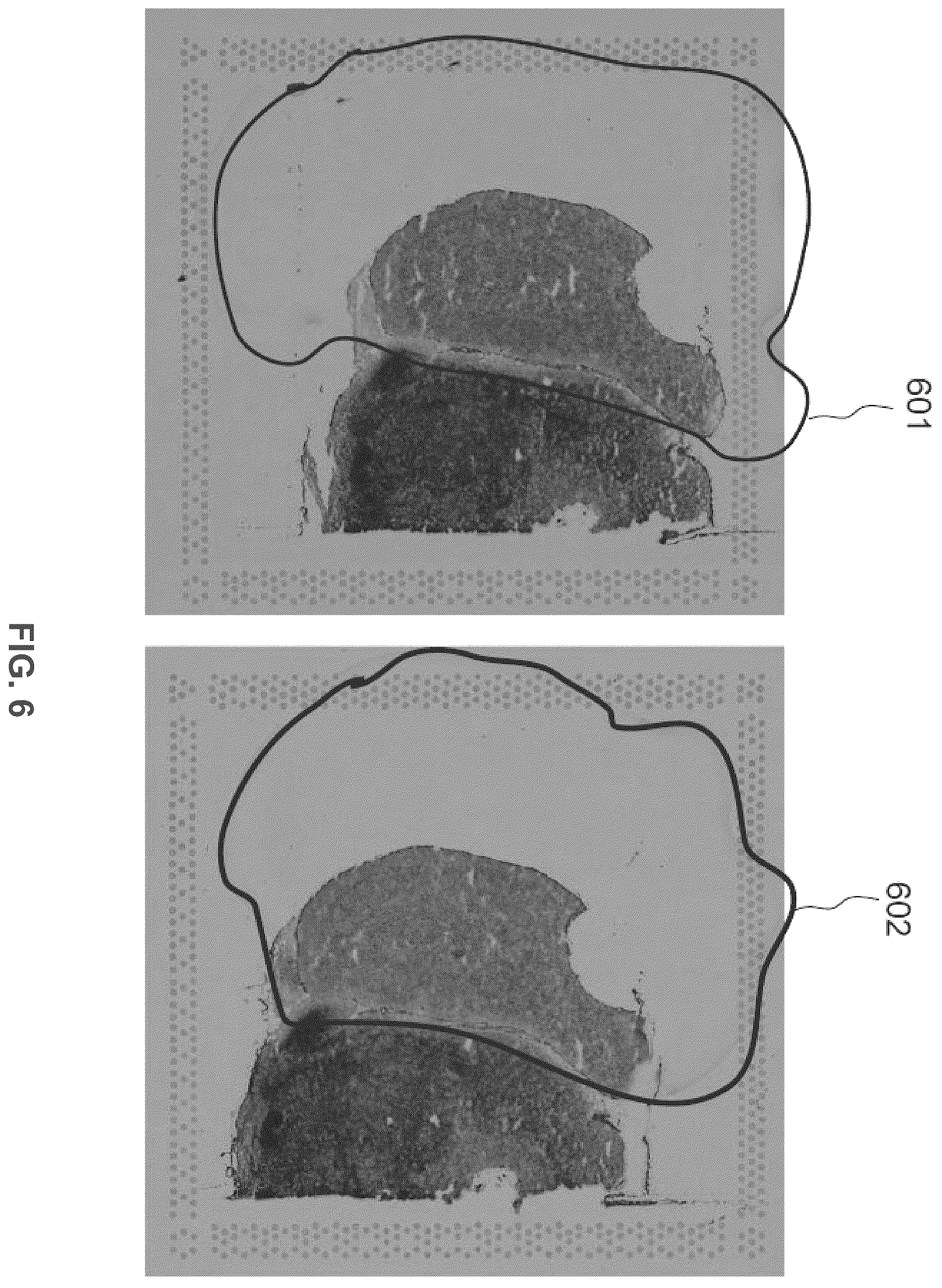 Patent US12365935 Figure 6 – Methods for increasing resolution of spatial analysis