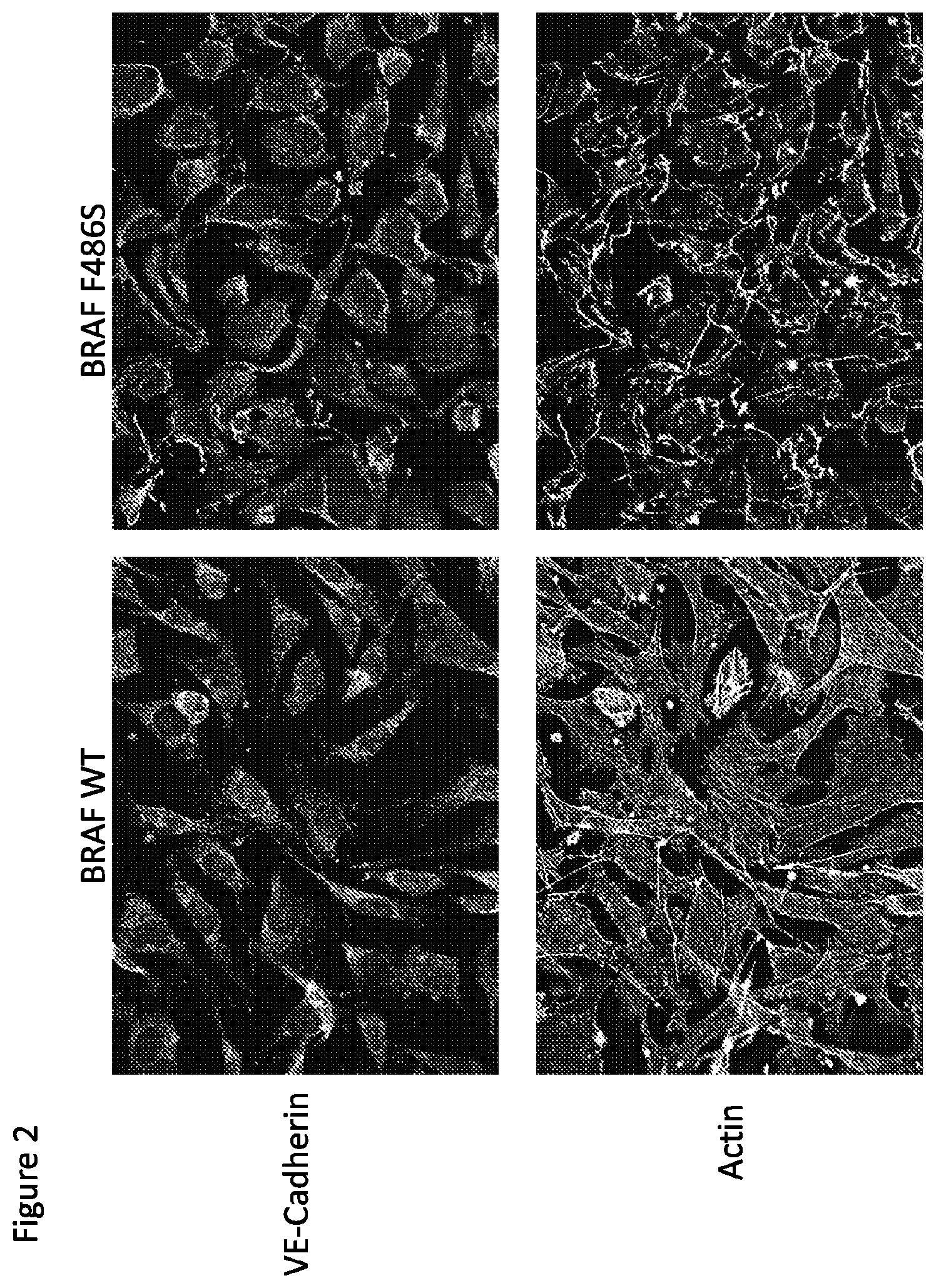 Patent US12365946 Figure 2 – Compositions and methods for the diagnosis and treatment of lymphatic system disorders