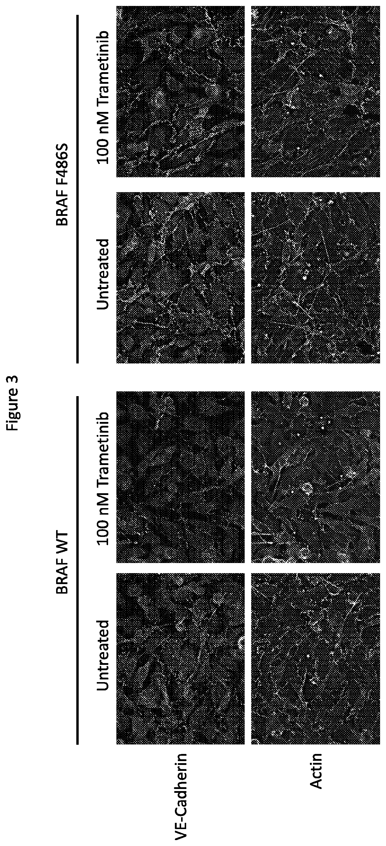 Patent US12365946 Figure 3 – Compositions and methods for the diagnosis and treatment of lymphatic system disorders