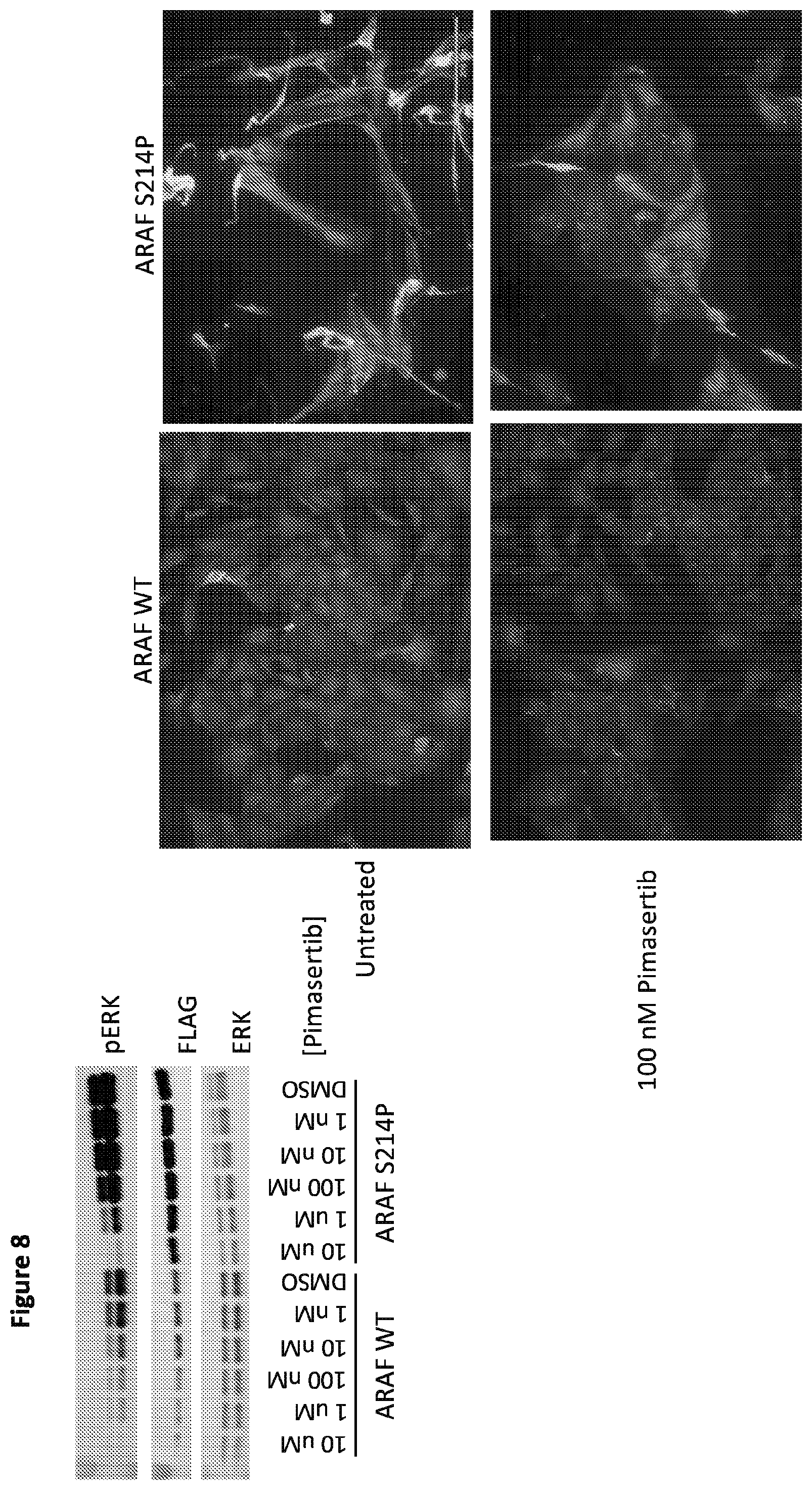 Patent US12365946 Figure 10 – Compositions and methods for the diagnosis and treatment of lymphatic system disorders