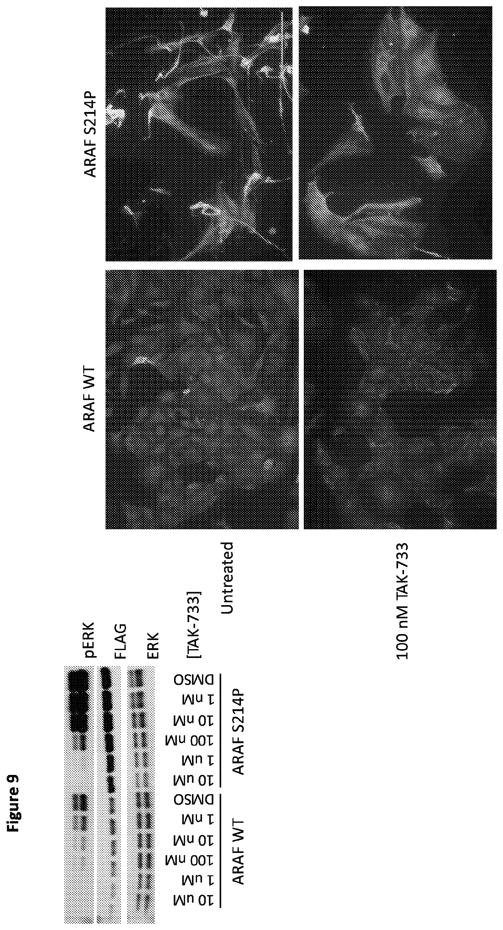 Patent US12365946 Figure 11 – Compositions and methods for the diagnosis and treatment of lymphatic system disorders