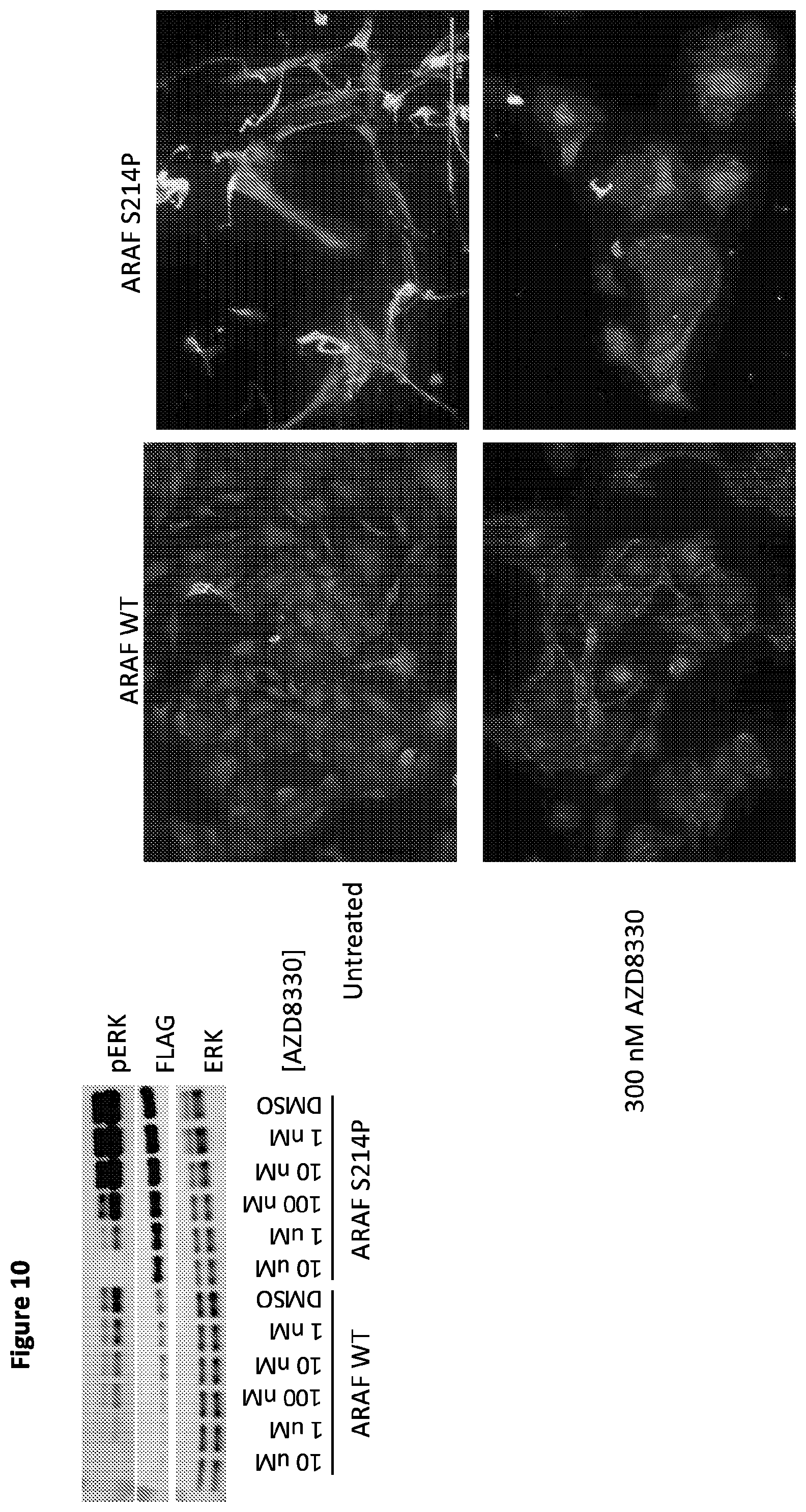Patent US12365946 Figure 12 – Compositions and methods for the diagnosis and treatment of lymphatic system disorders