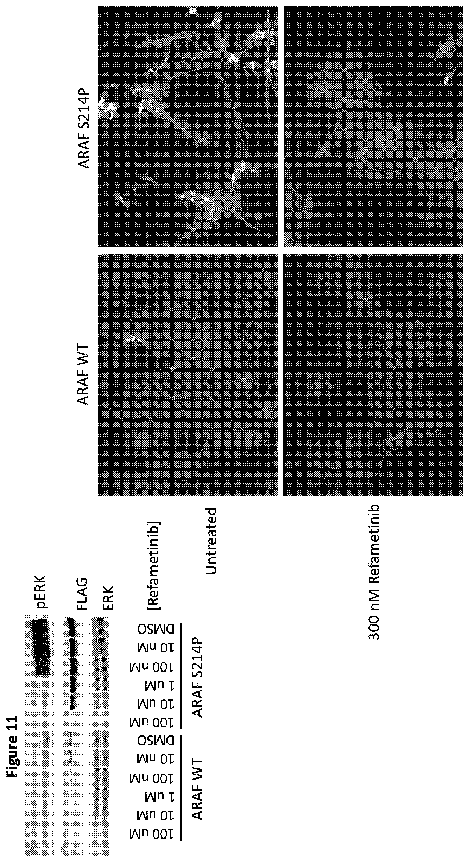 Patent US12365946 Figure 13 – Compositions and methods for the diagnosis and treatment of lymphatic system disorders