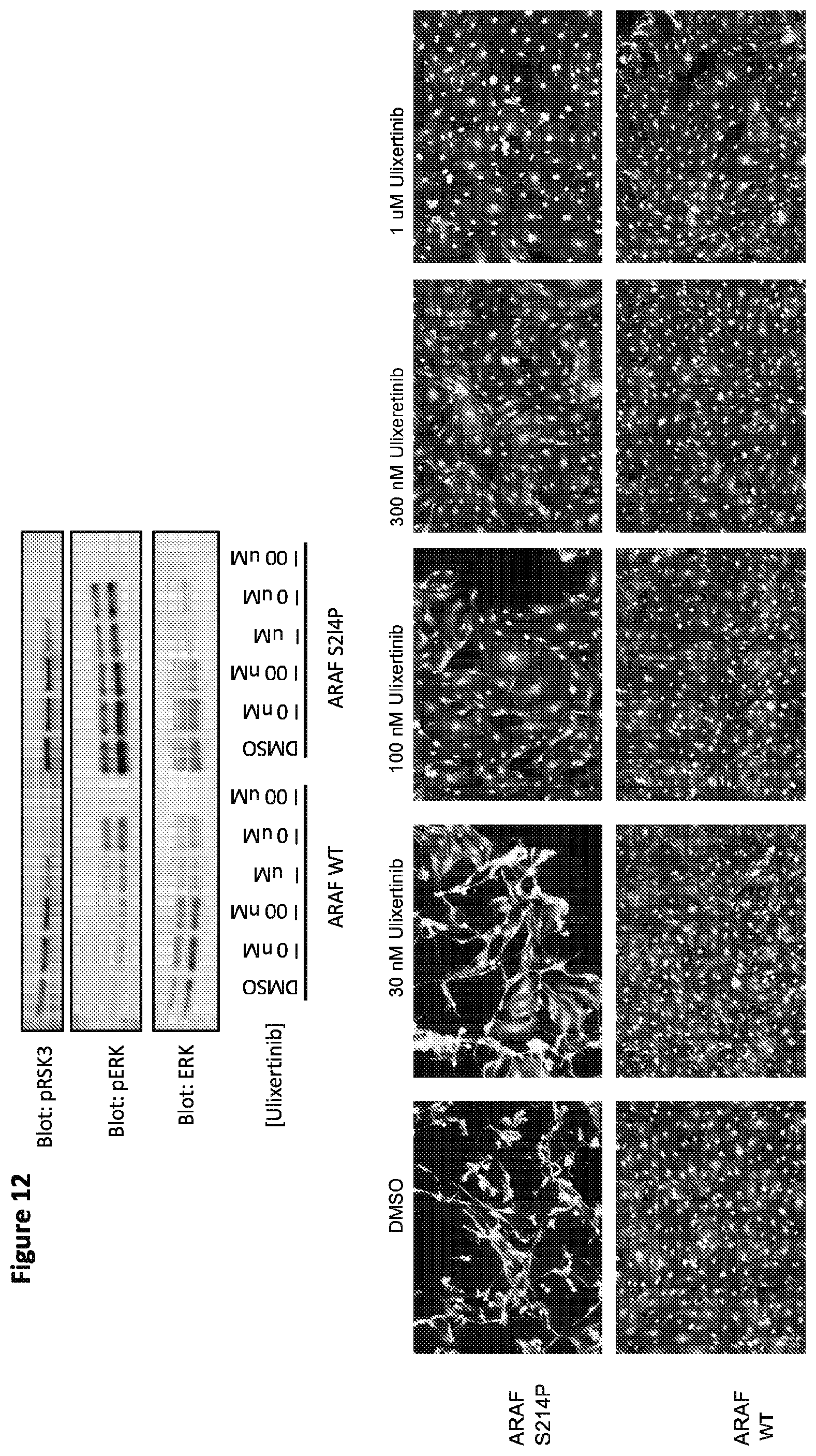 Patent US12365946 Figure 14 – Compositions and methods for the diagnosis and treatment of lymphatic system disorders