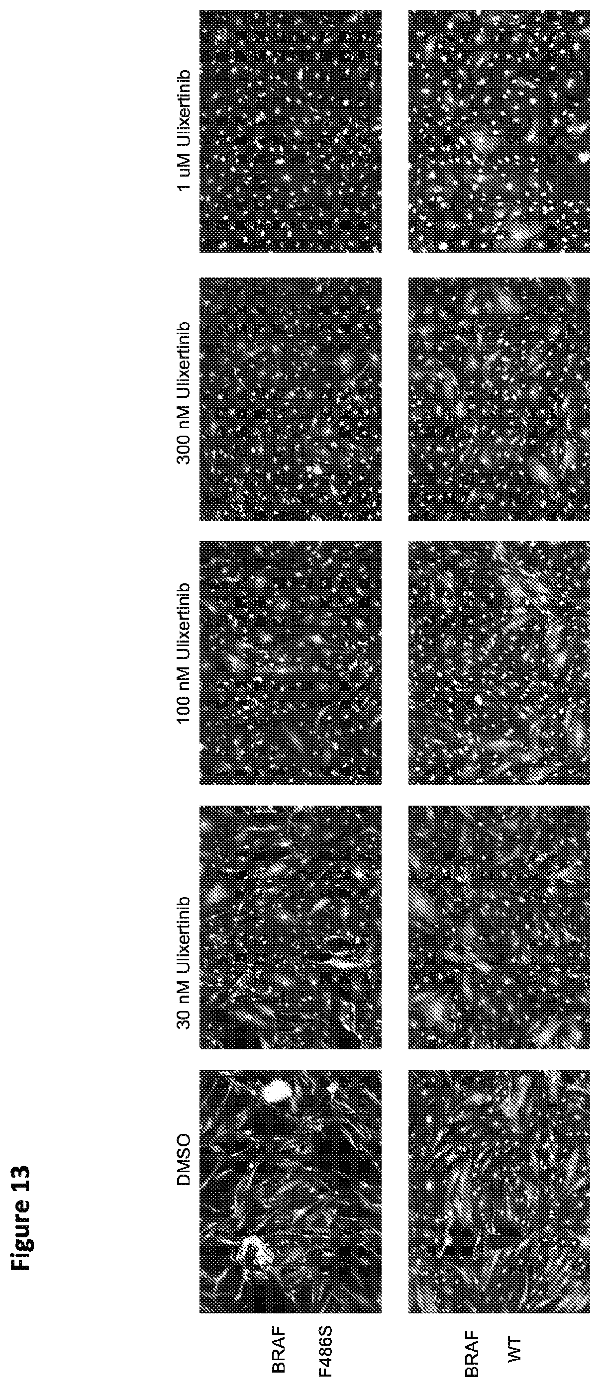 Patent US12365946 Figure 15 – Compositions and methods for the diagnosis and treatment of lymphatic system disorders