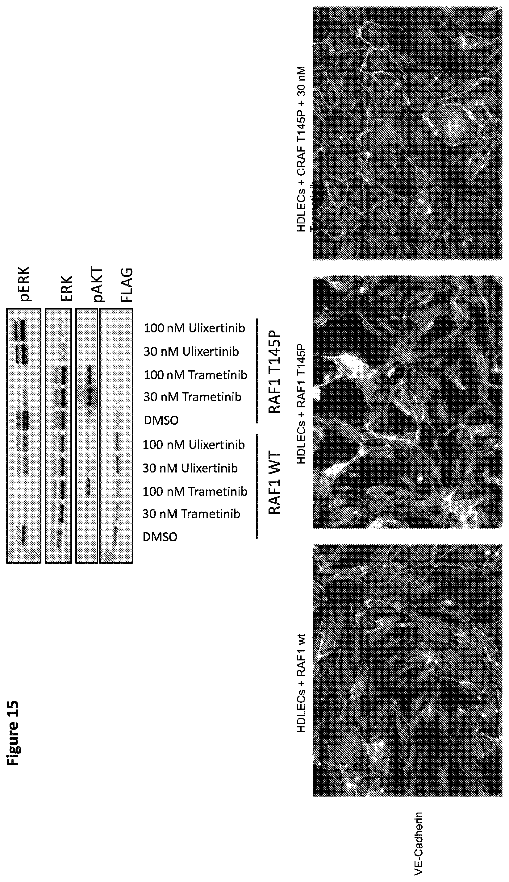 Patent US12365946 Figure 17 – Compositions and methods for the diagnosis and treatment of lymphatic system disorders