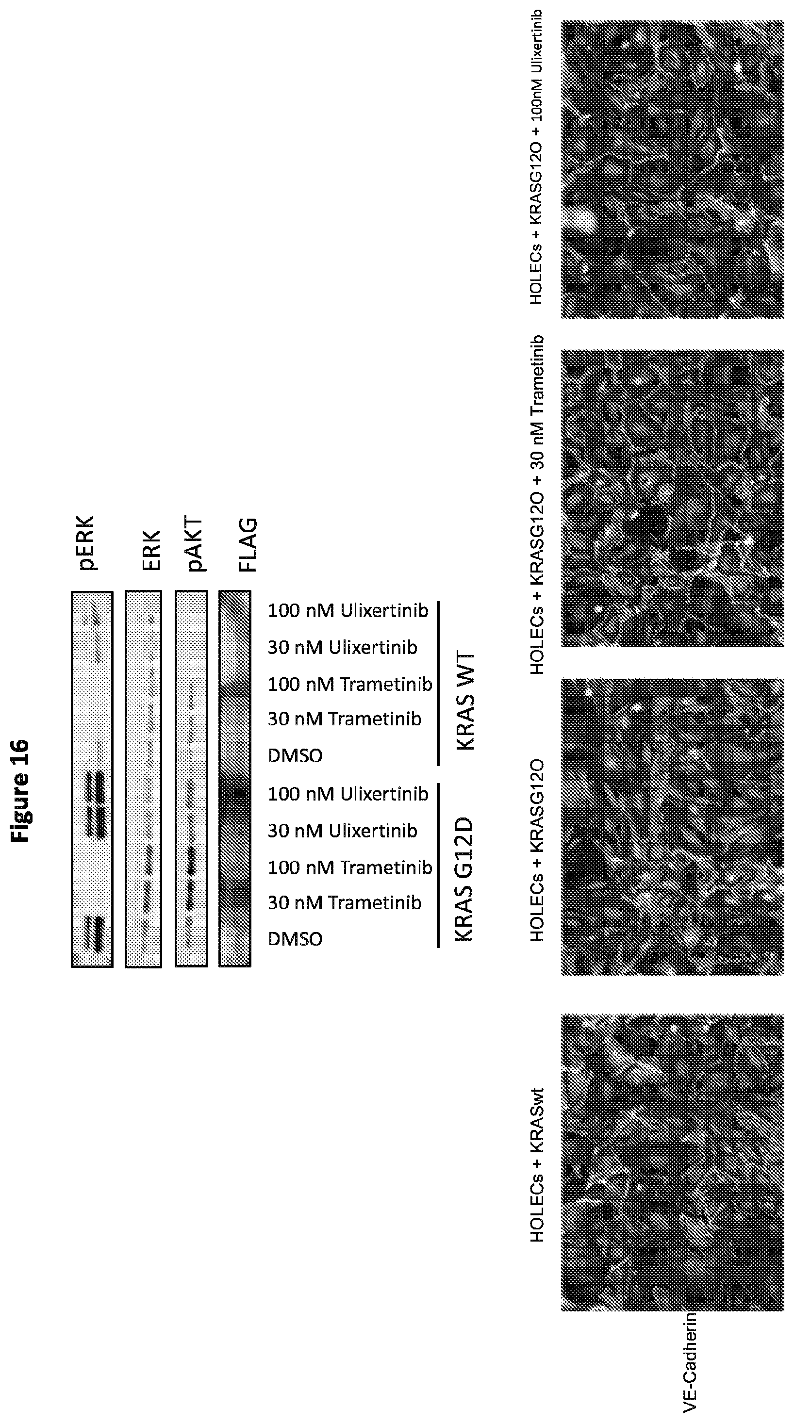 Patent US12365946 Figure 18 – Compositions and methods for the diagnosis and treatment of lymphatic system disorders