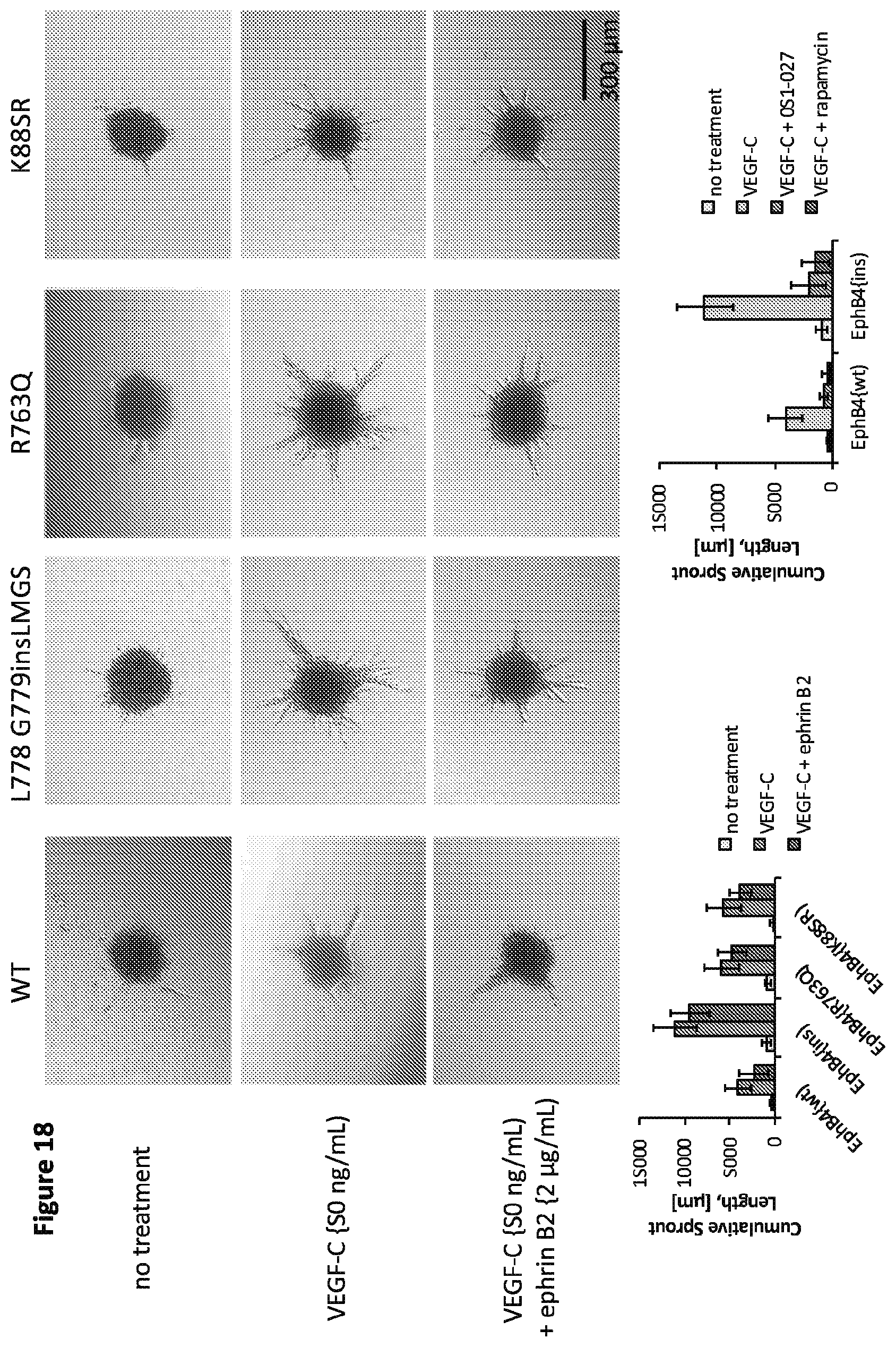 Patent US12365946 Figure 20 – Compositions and methods for the diagnosis and treatment of lymphatic system disorders