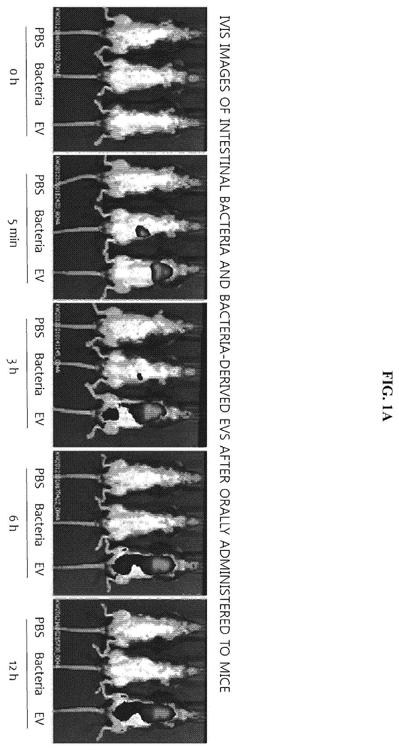 Patent US12365949 Figure 1 – Method for diagnosing ovarian cancer through microbial metagenome analysis