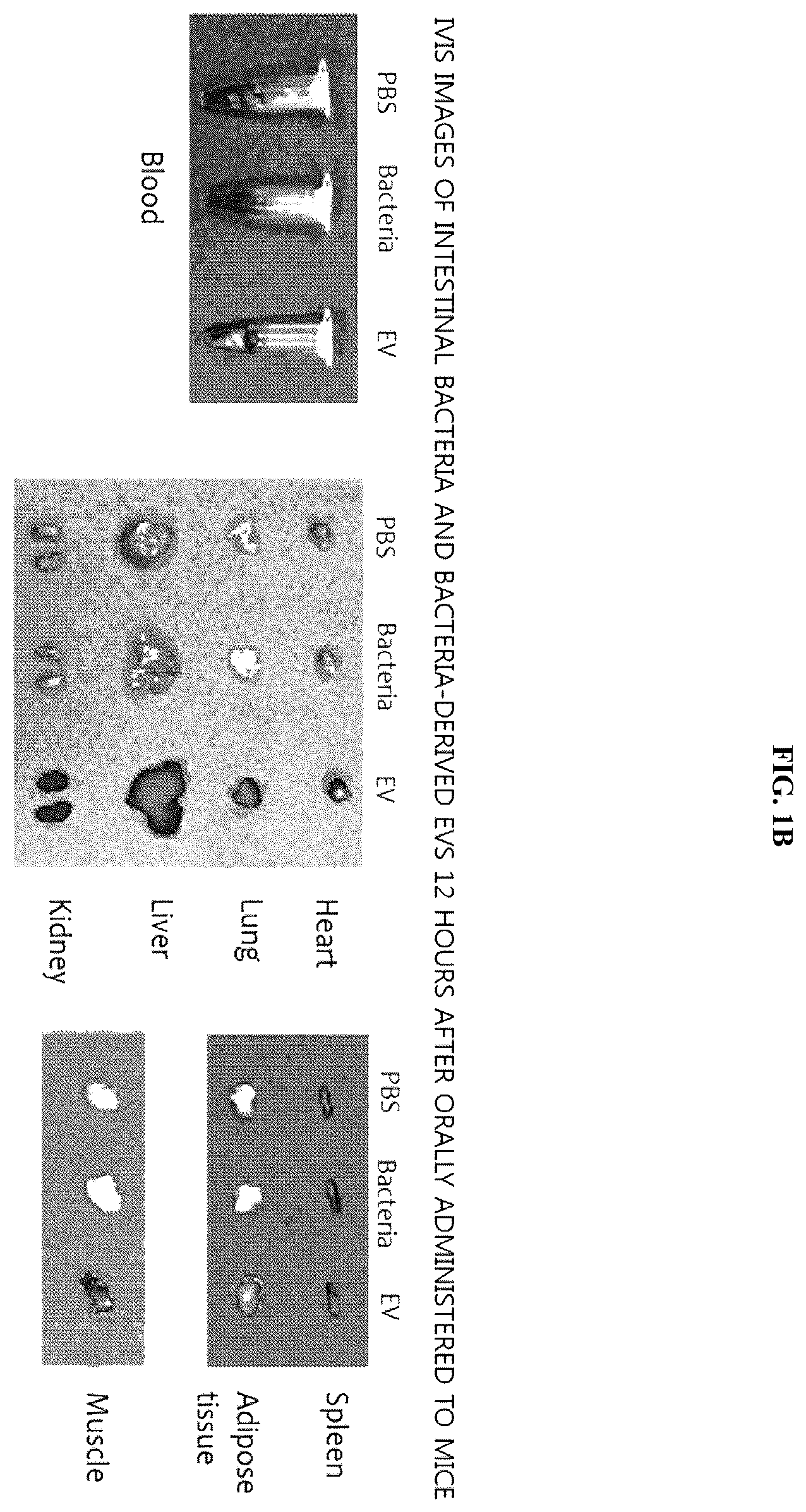 Patent US12365949 Figure 2 – Method for diagnosing ovarian cancer through microbial metagenome analysis