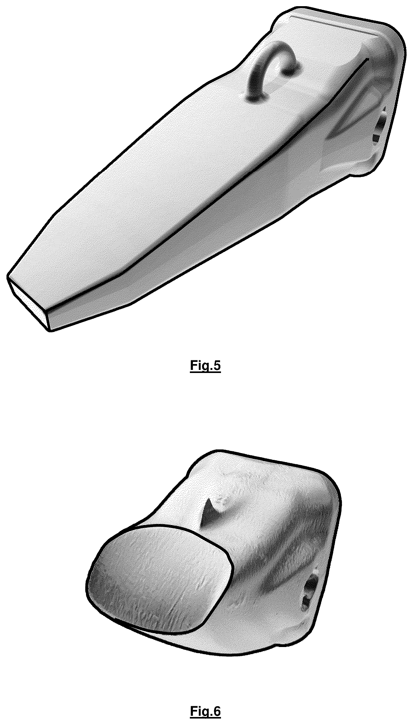 Patent US12365969 Figure 3 – Hierarchical composite wear part with structural reinforcement