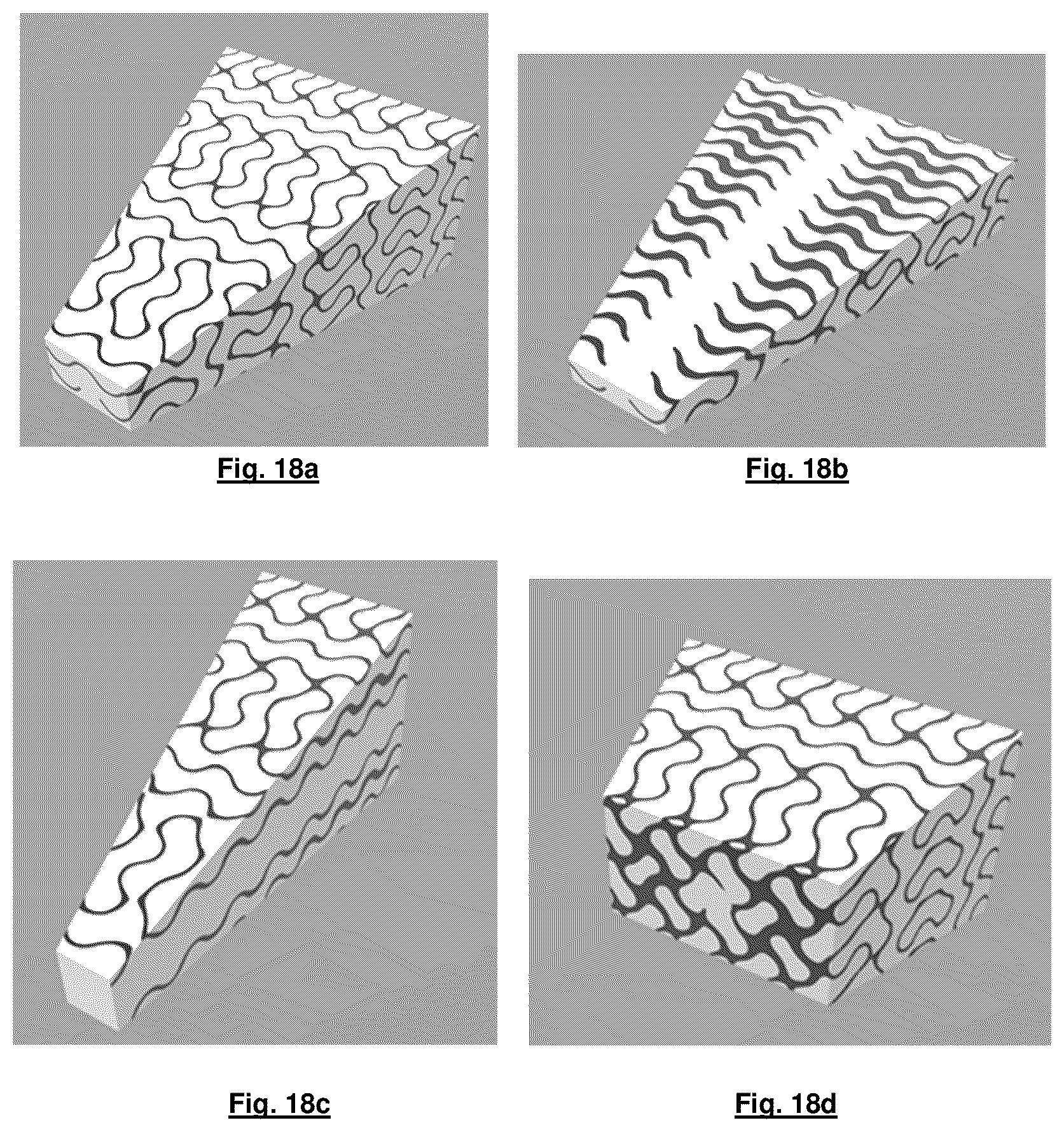 Patent US12365969 Figure 9 – Hierarchical composite wear part with structural reinforcement