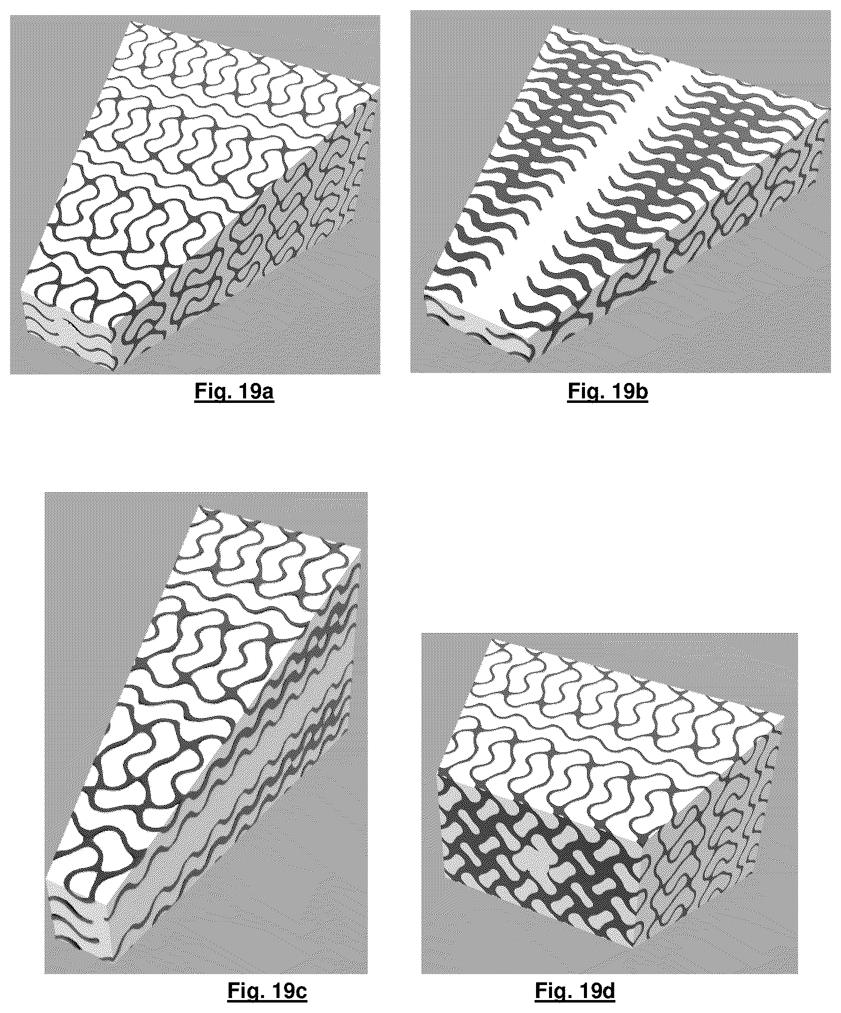 Patent US12365969 Figure 10 – Hierarchical composite wear part with structural reinforcement