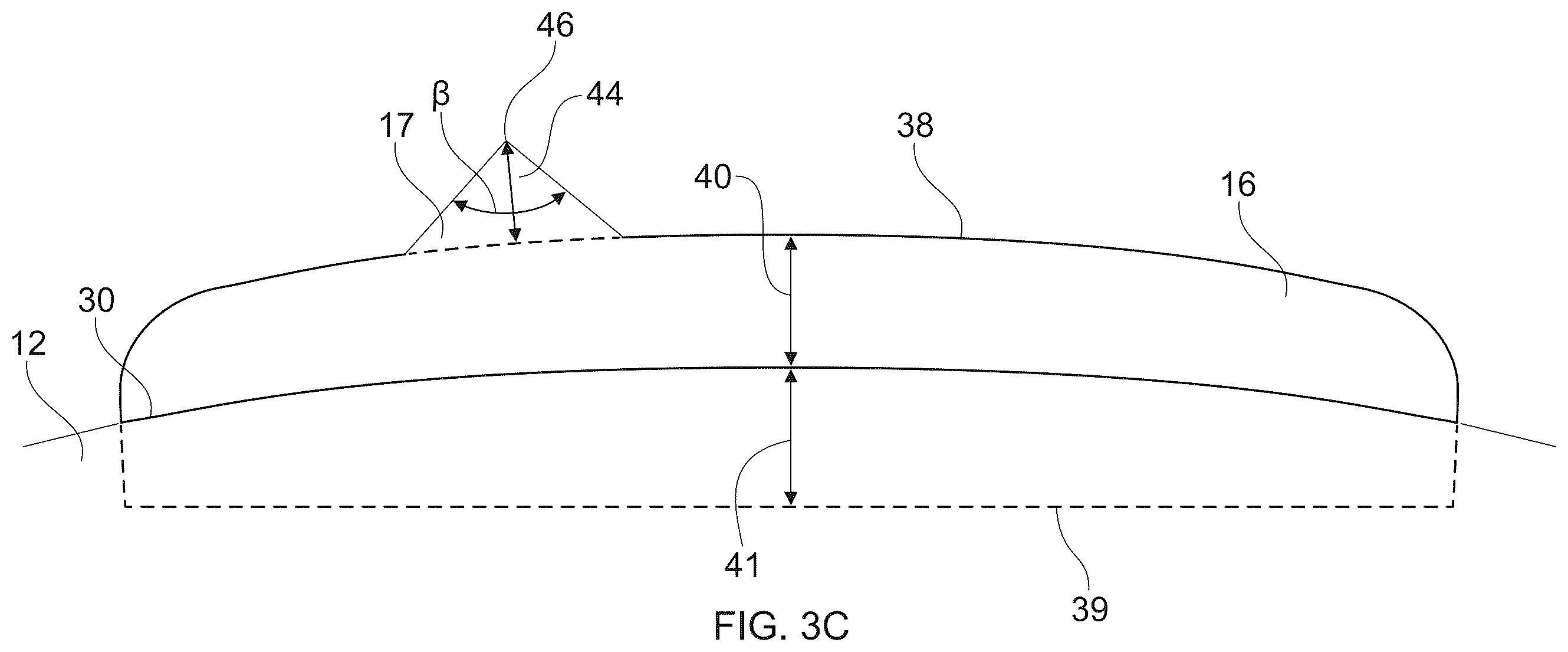 Patent US12366038 Figure 6 – Sanitary tissue product with a shaped line of weakness