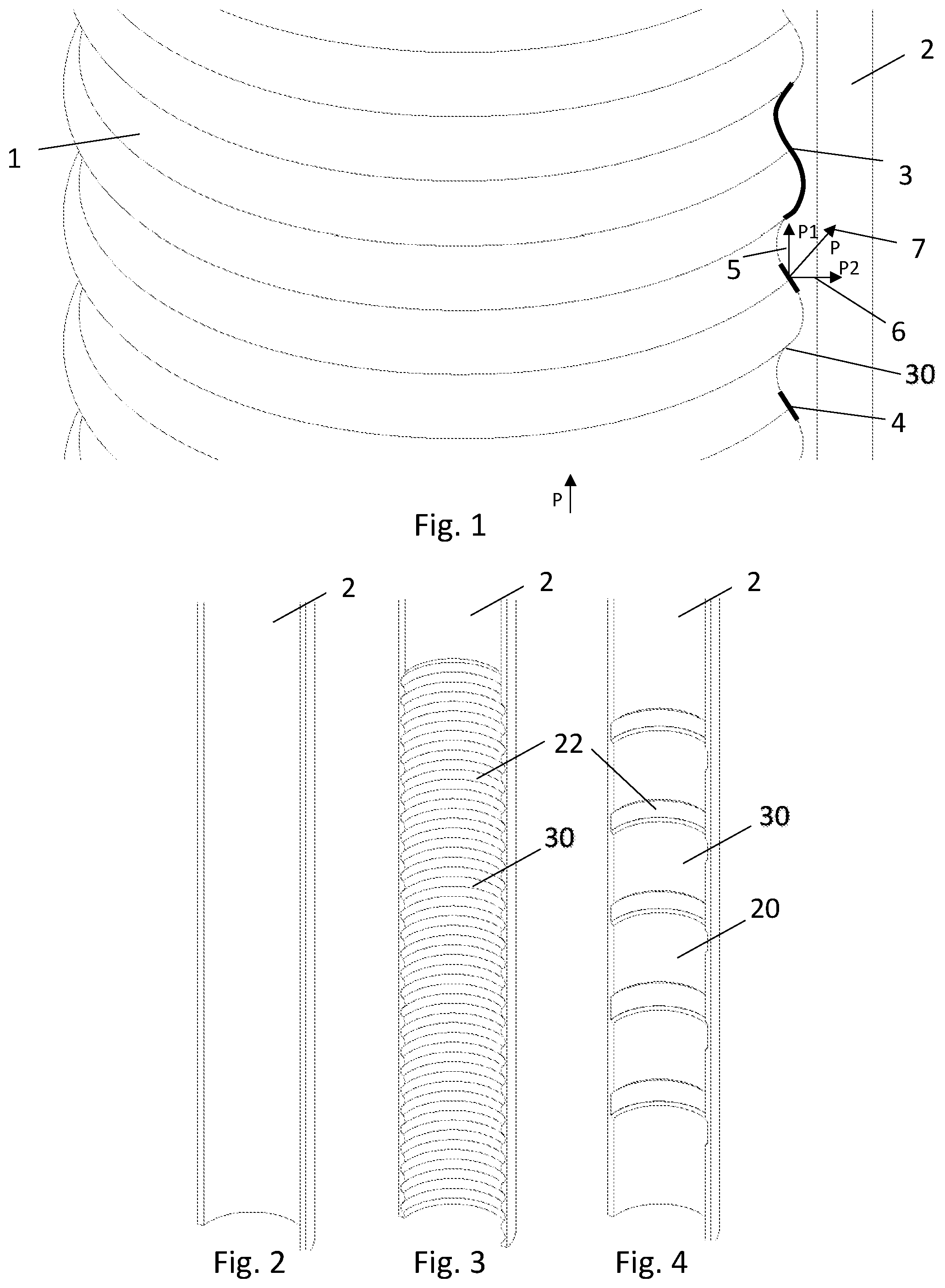 Patent US12366134 Figure 1 – Method for preparing a wellbore