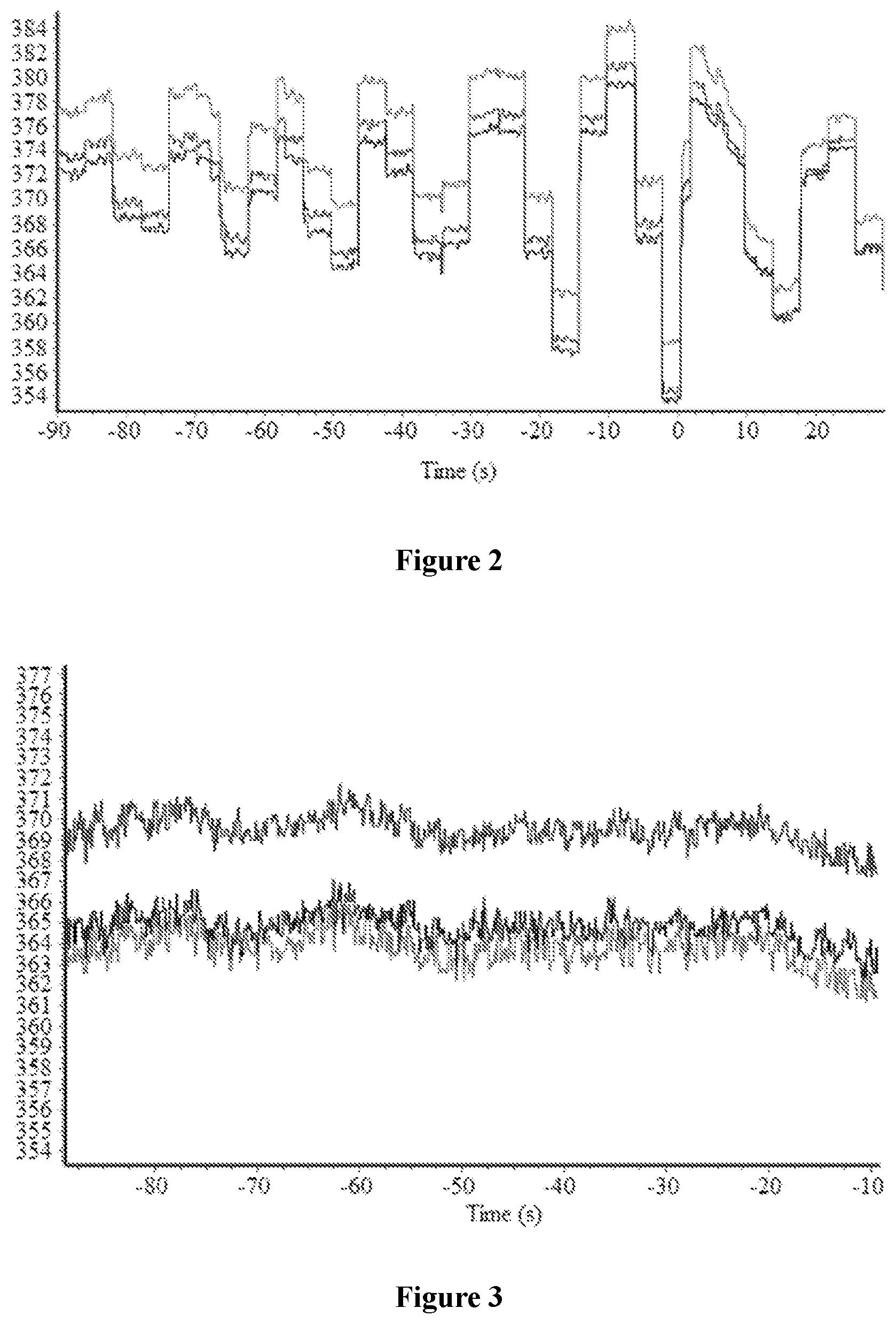 Patent US12366227 Figure 2 – Method and apparatus for controlling reactive power of wind turbine, and wind farm