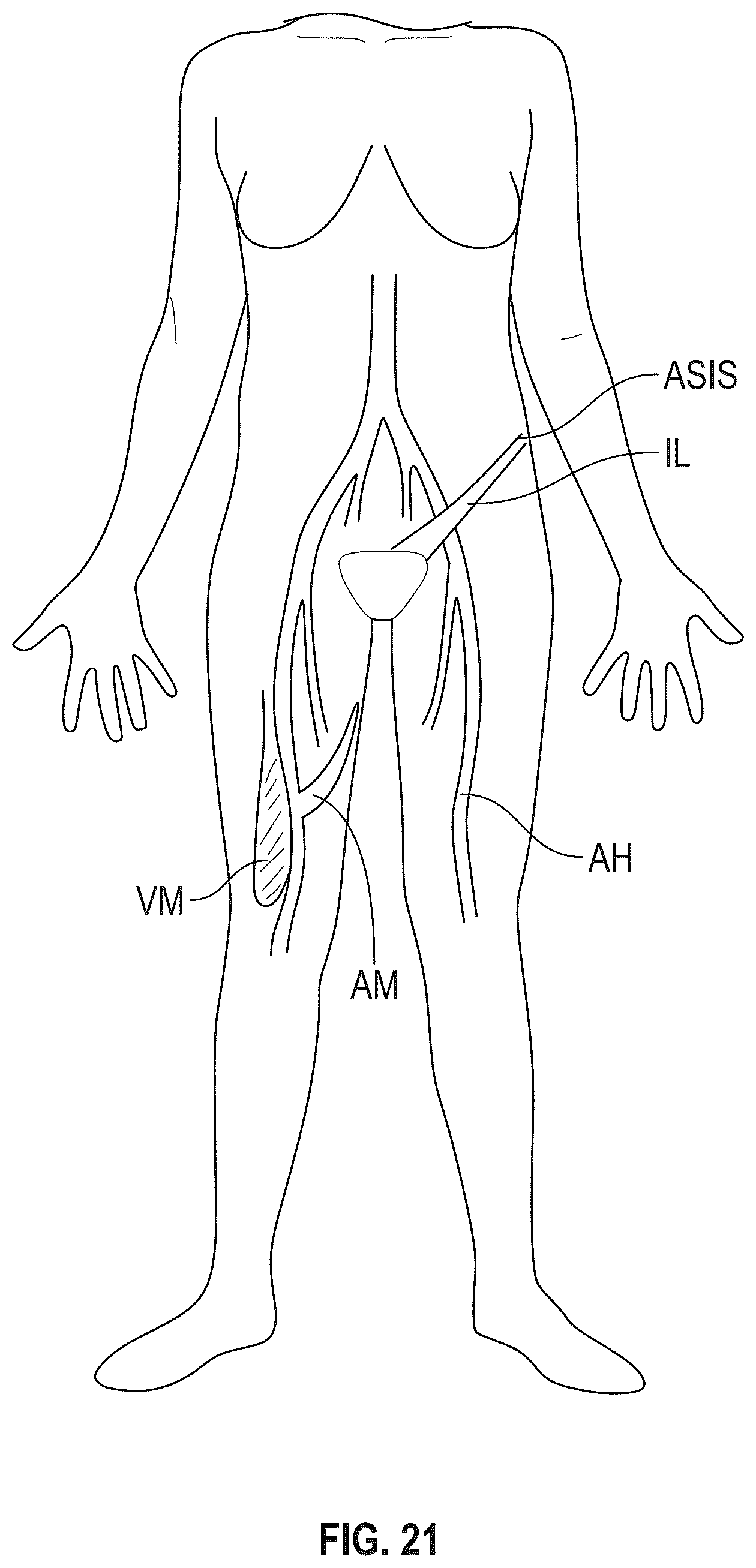 Patent US12366439 Figure 18 – Measuring device and a measurement method thereof