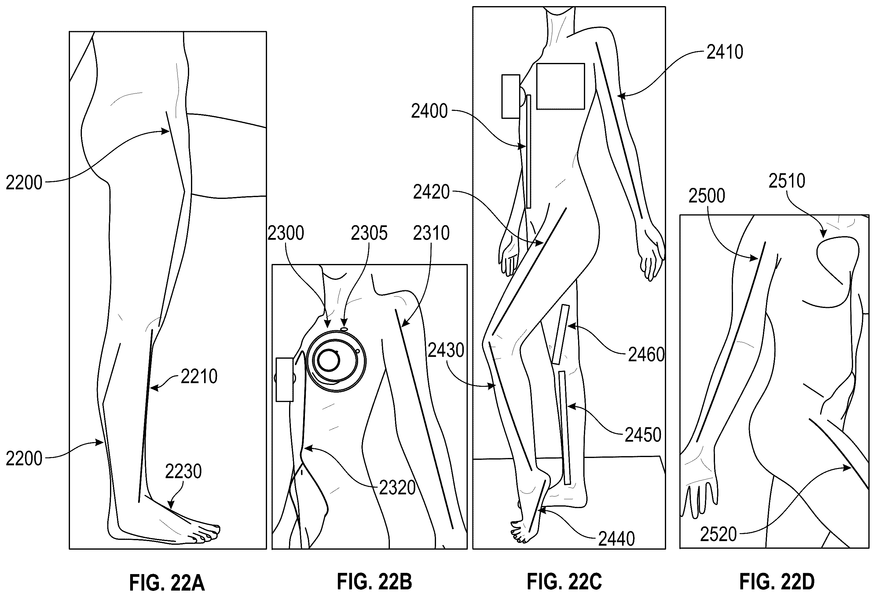 Patent US12366439 Figure 19 – Measuring device and a measurement method thereof