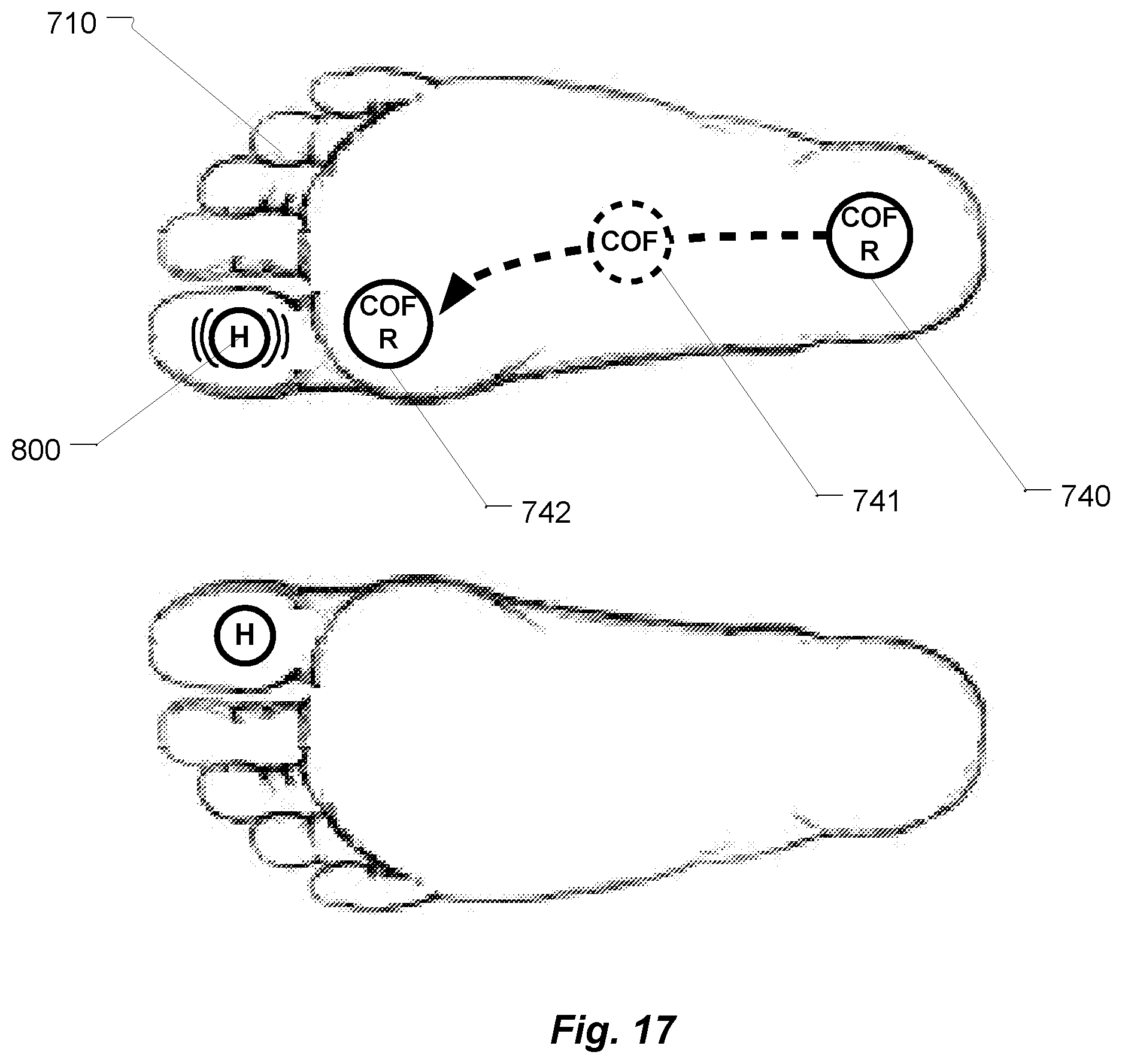 Patent US12366496 Figure 17 – Methods for calibrating a motion and ground reaction force analysis system