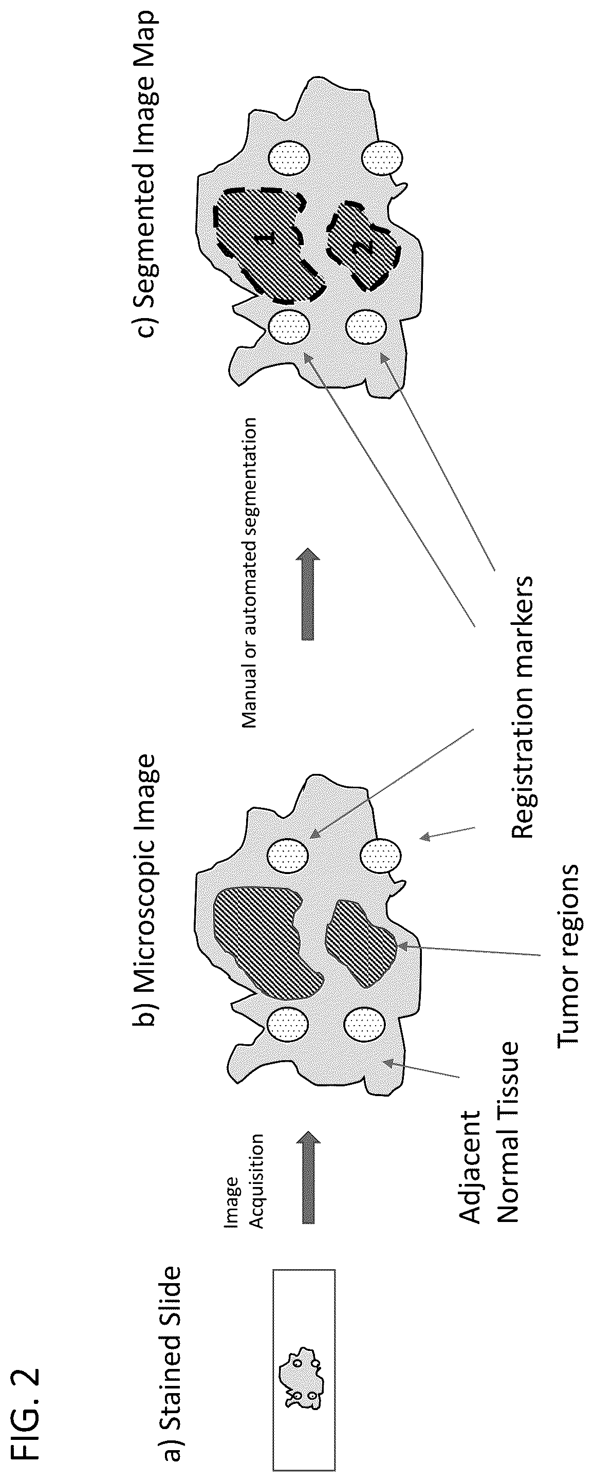 Patent US12366505 Figure 2 – Enrichment of surgical specimens for tumor tissue