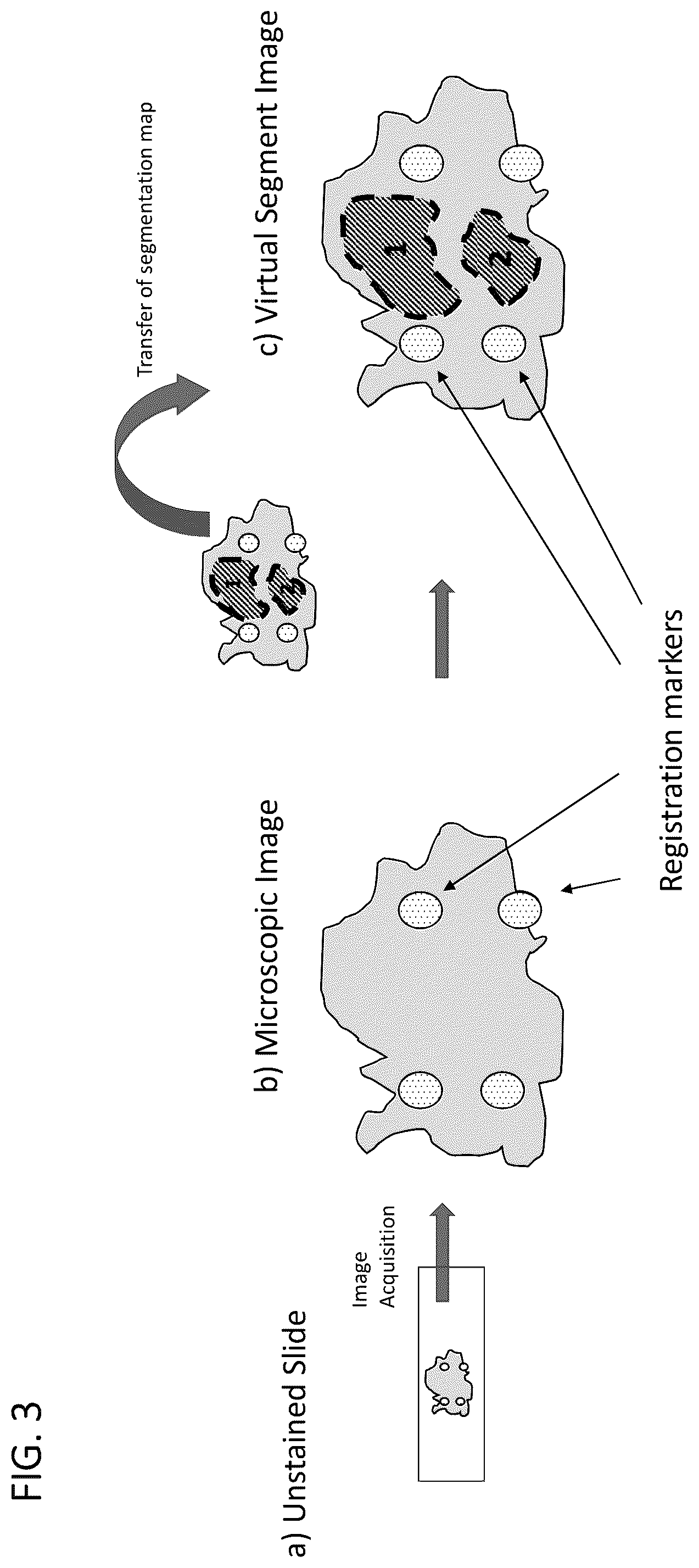 Patent US12366505 Figure 3 – Enrichment of surgical specimens for tumor tissue