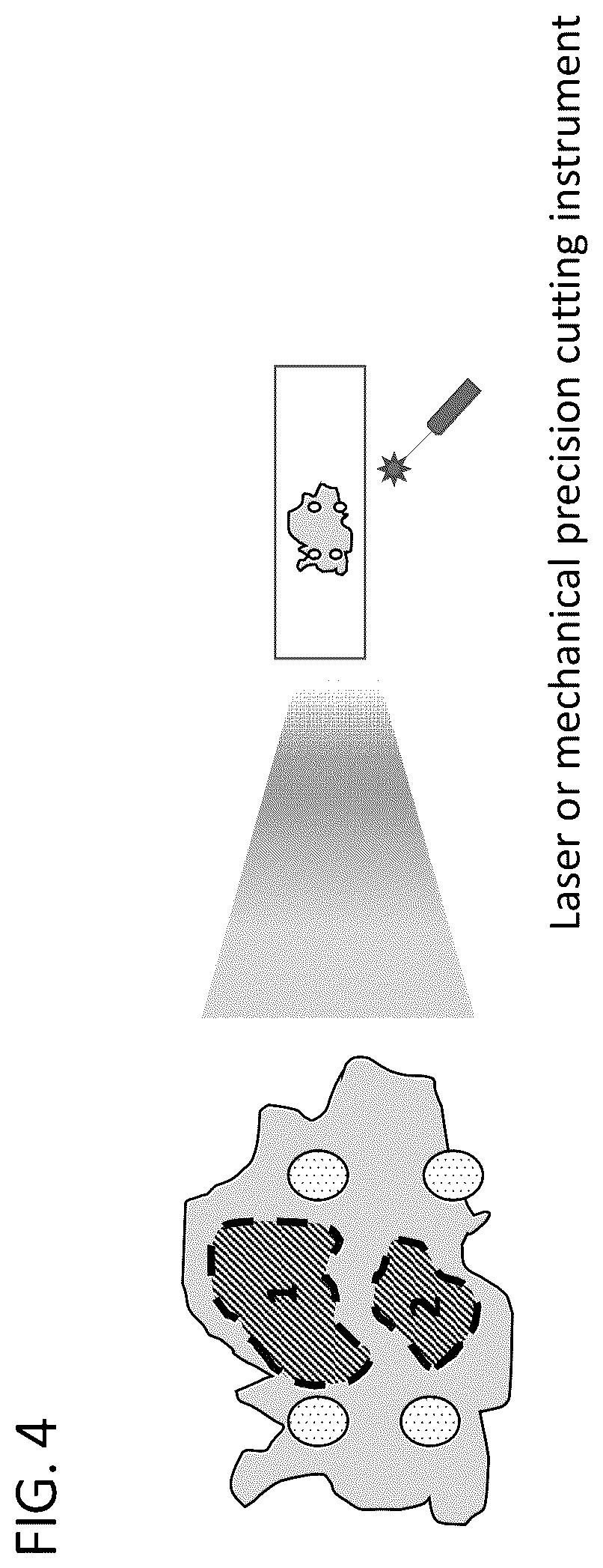 Patent US12366505 Figure 4 – Enrichment of surgical specimens for tumor tissue