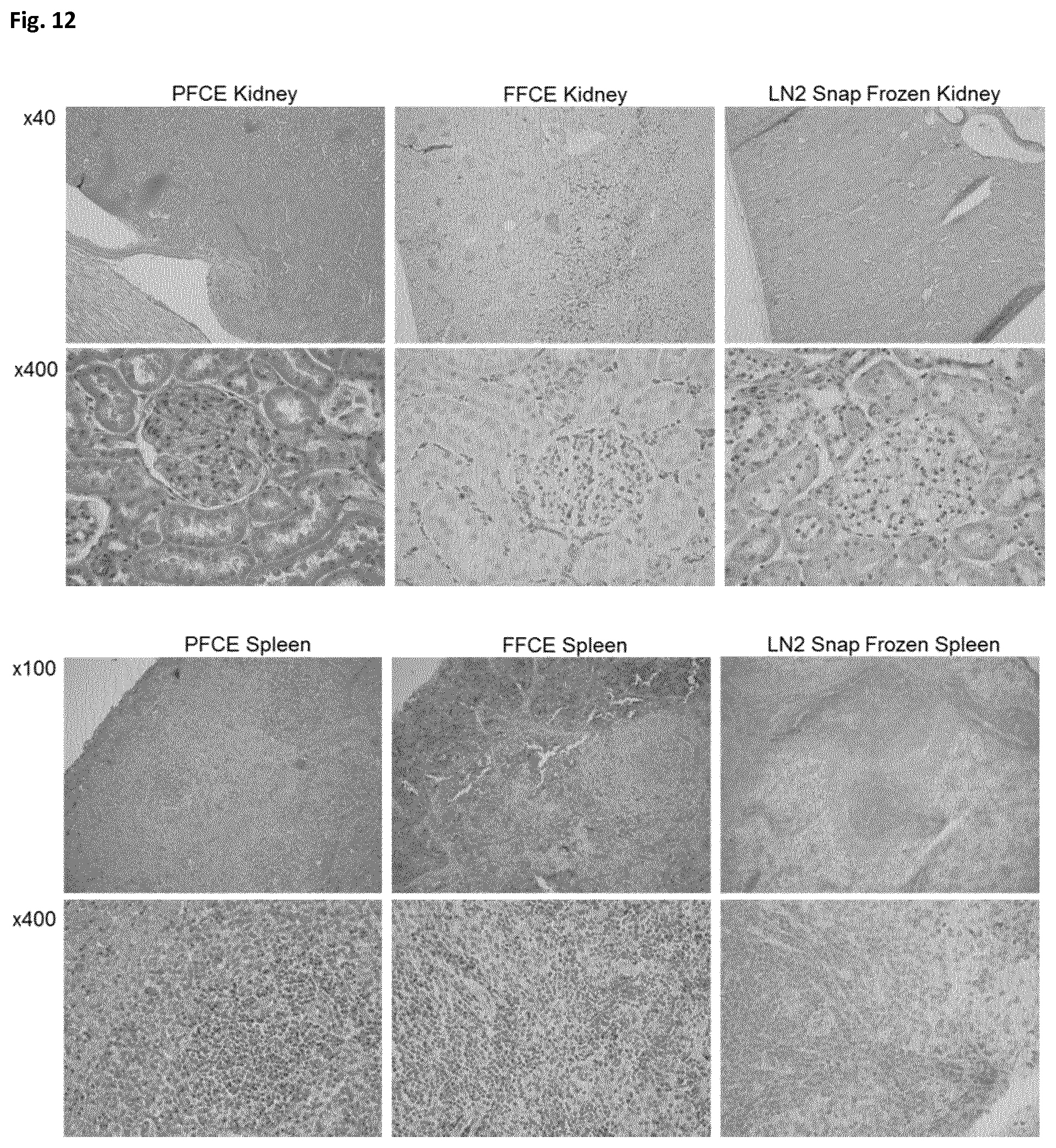 Patent US12366508 Figure 12 – Method of preparing a frozen biological sample