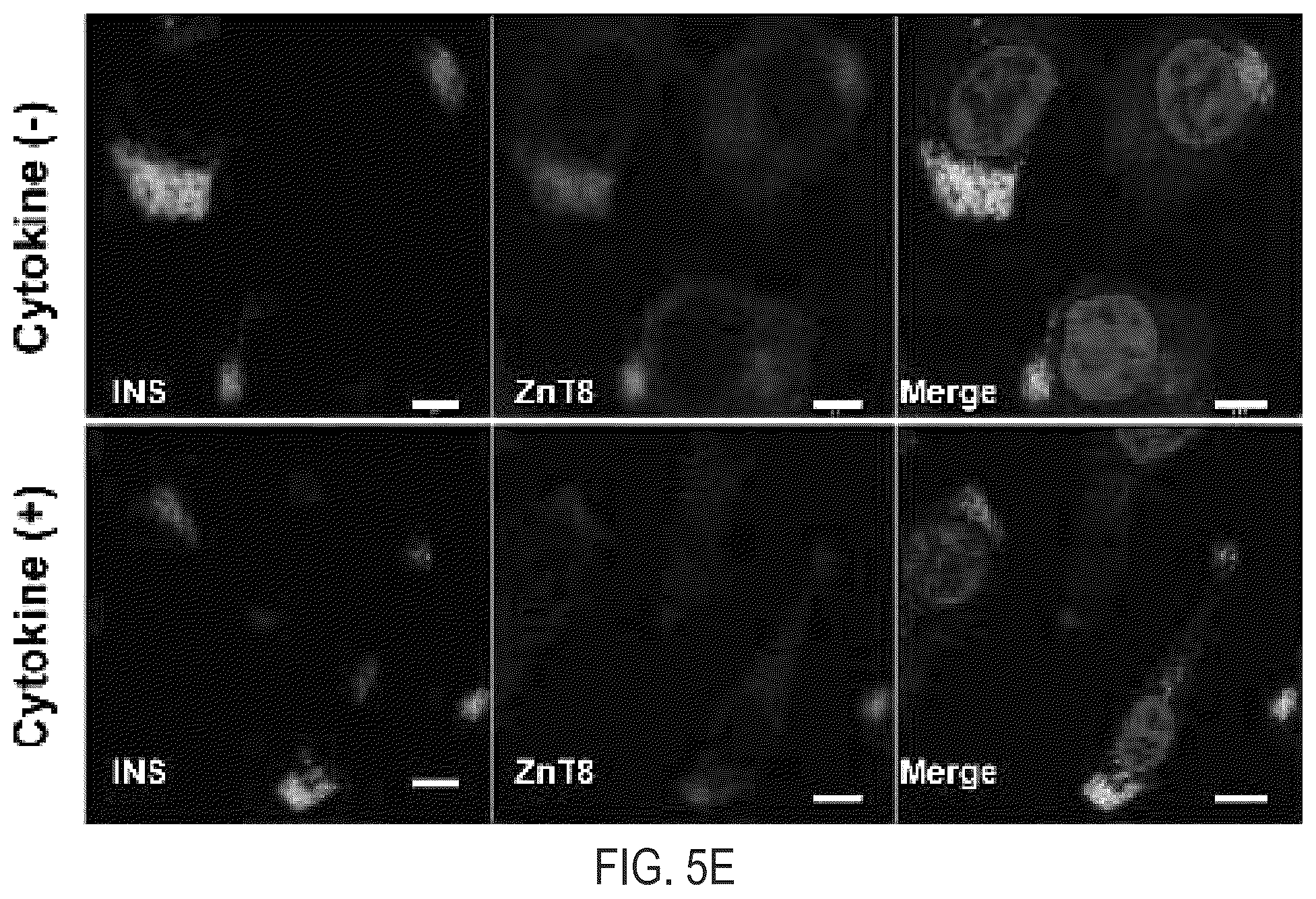 Patent US12366570 Figure 10 – Cell-based ZNT8 assay