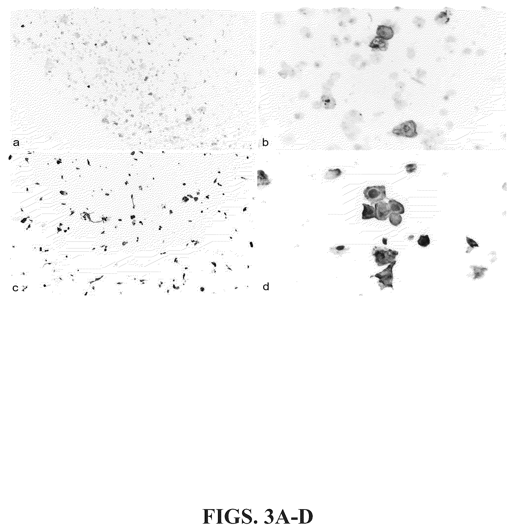 Patent US12366574 Figure 3 – Keratin 17 as a biomarker for bladder cancer