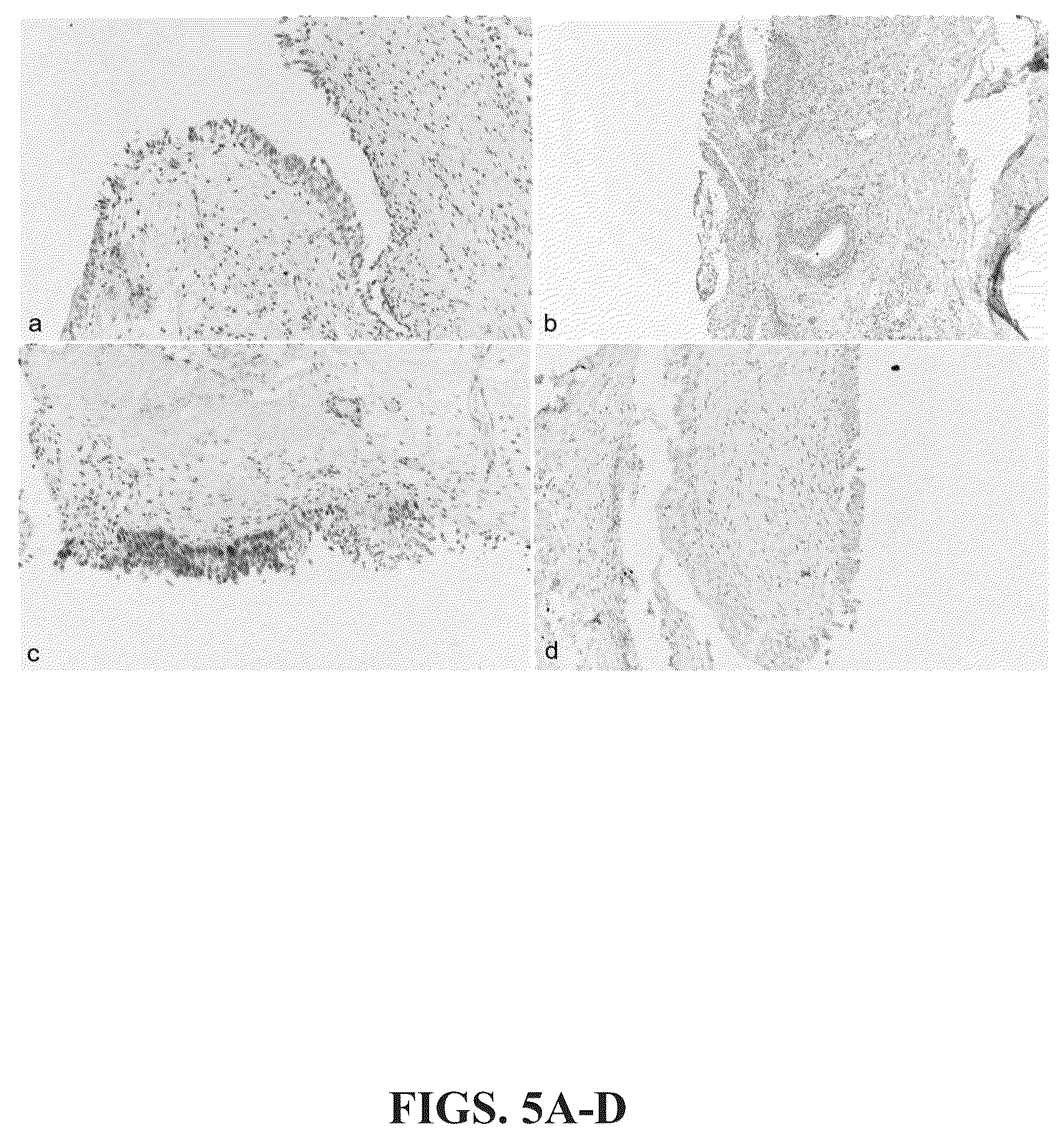 Patent US12366574 Figure 5 – Keratin 17 as a biomarker for bladder cancer