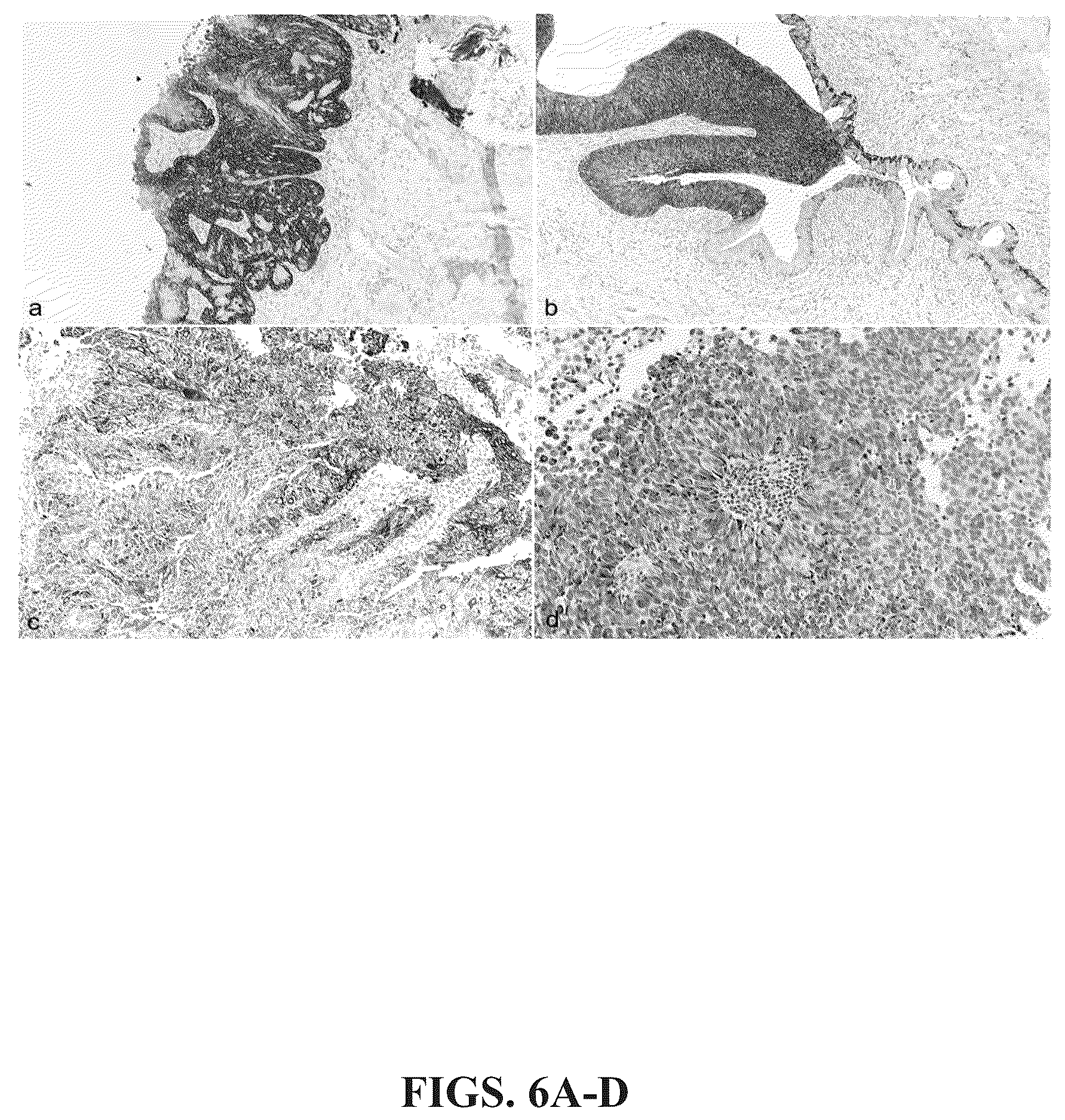 Patent US12366574 Figure 6 – Keratin 17 as a biomarker for bladder cancer
