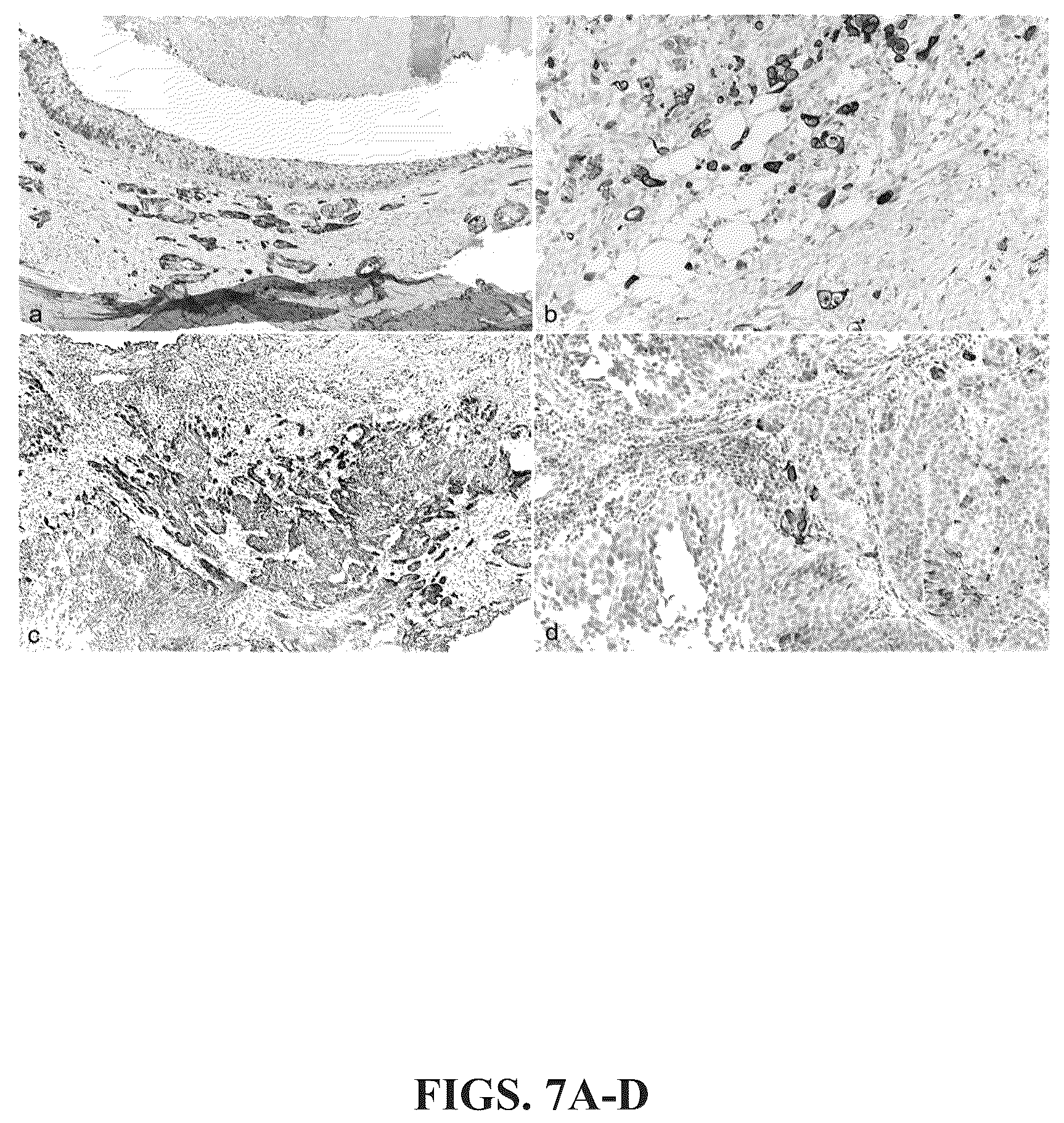 Patent US12366574 Figure 7 – Keratin 17 as a biomarker for bladder cancer