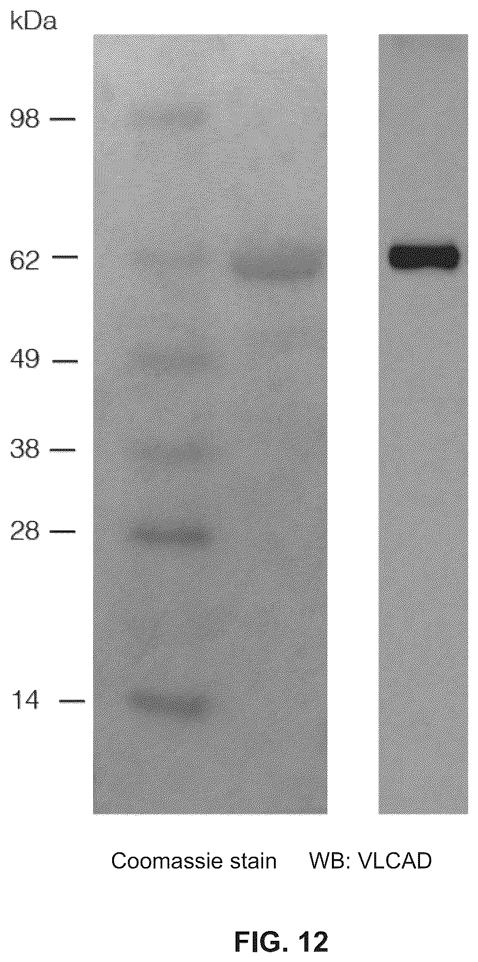 Patent US12366576 Figure 13 – Compositions, assays, and methods for direct modulation of fatty acid metabolism
