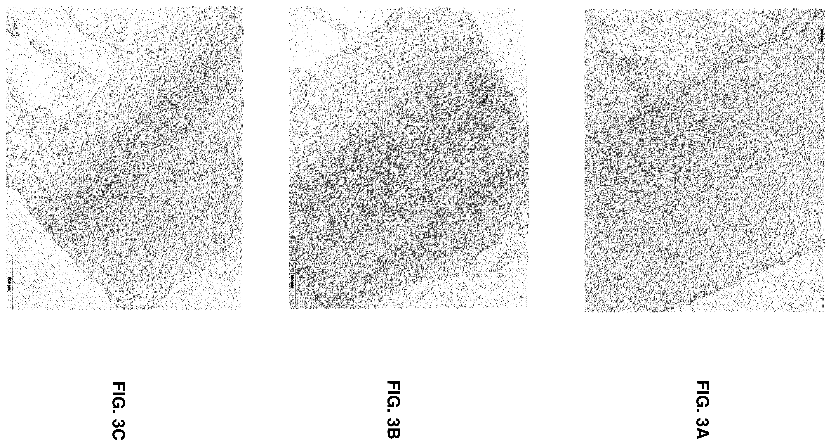 Patent US12366582 Figure 3 – Collagen type X alpha-1 assay