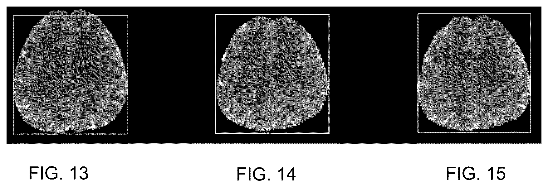 Patent US12366619 Figure 12 – Magnetic resonance scanning method and system and computer-readable storage medium