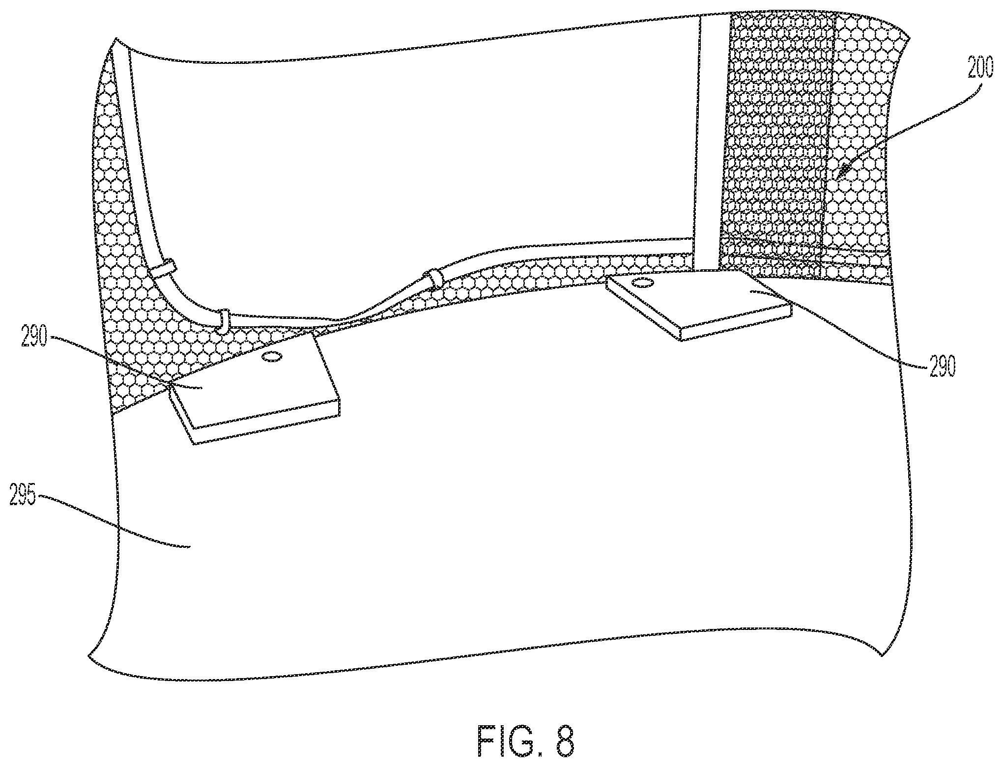Patent US12366622 Figure 13 – Radio frequency coil for magnetic resonance imaging