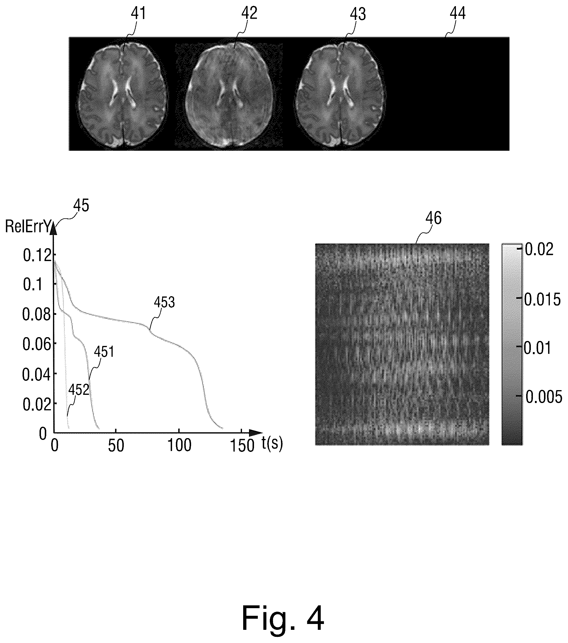 Patent US12366624 Figure 3 – Motion correction method and apparatus for magnetic resonance image, and magnetic resonance imaging system