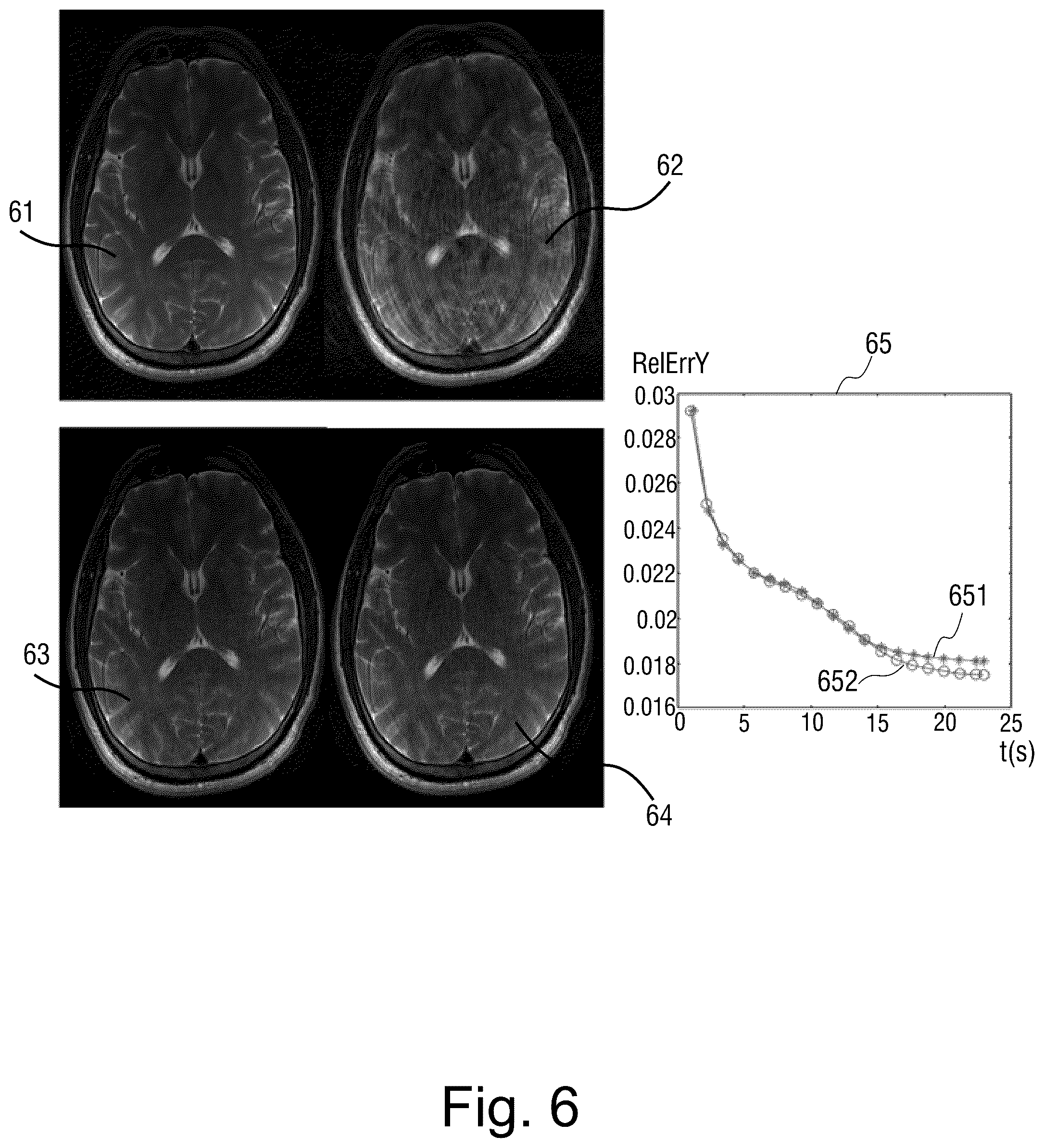 Patent US12366624 Figure 5 – Motion correction method and apparatus for magnetic resonance image, and magnetic resonance imaging system