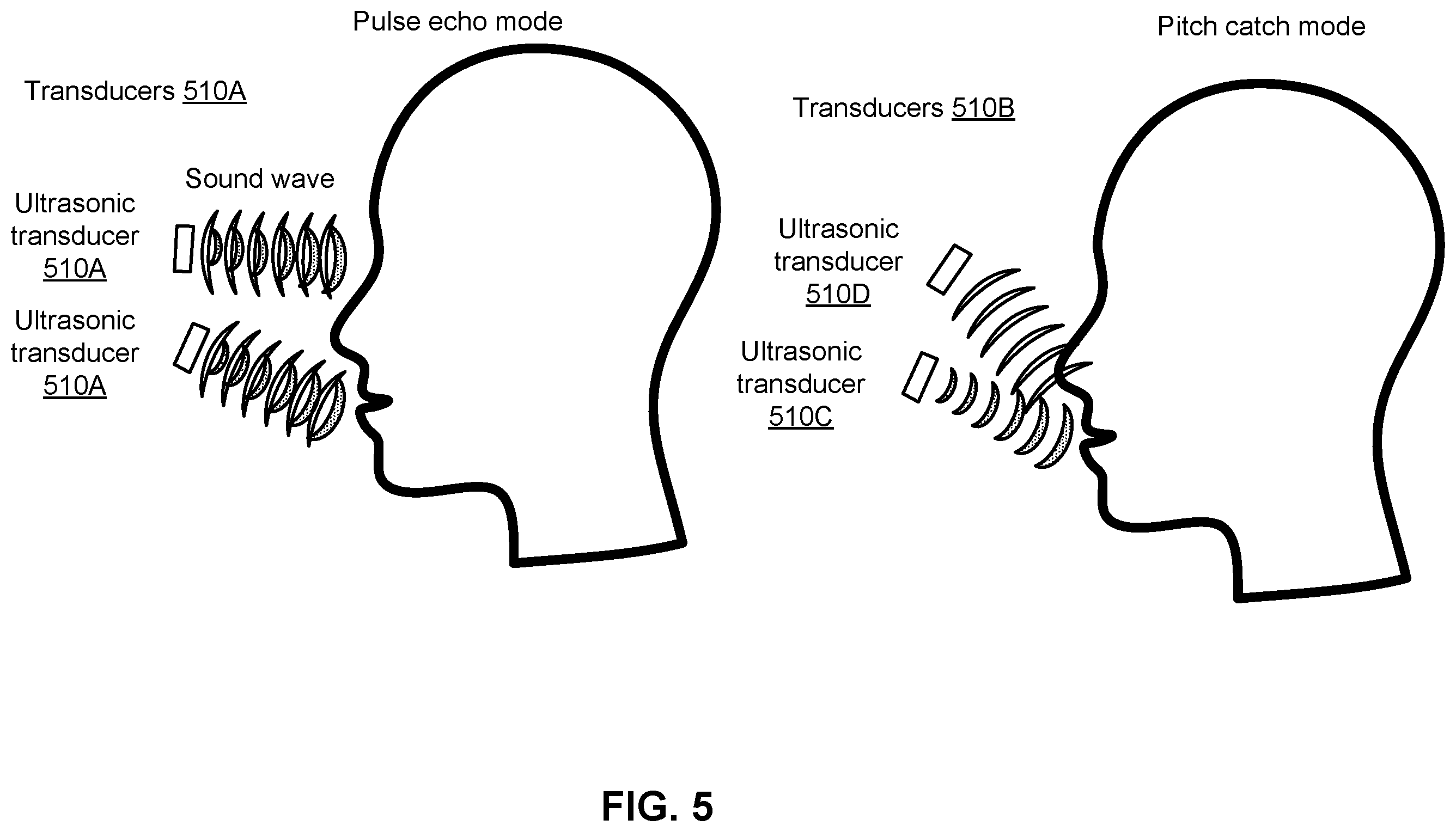 Patent US12366656 Figure 6 – Tracking facial expressions using ultrasound and millimeter waves