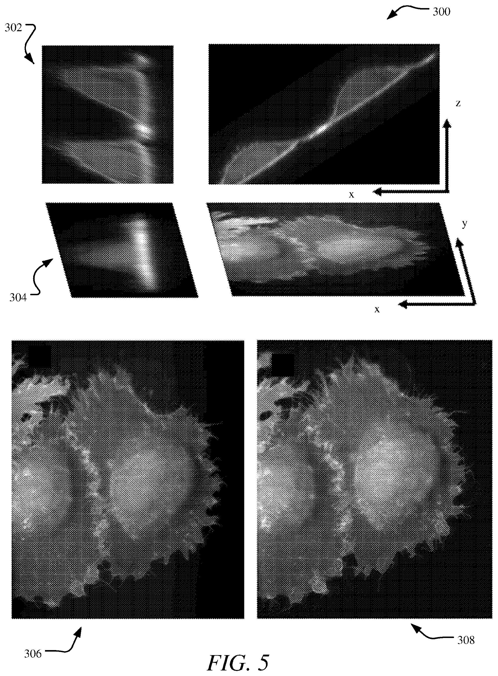 Patent US12366740 Figure 5 – Systems and methods for live projection imaging for fluorescence microscopy