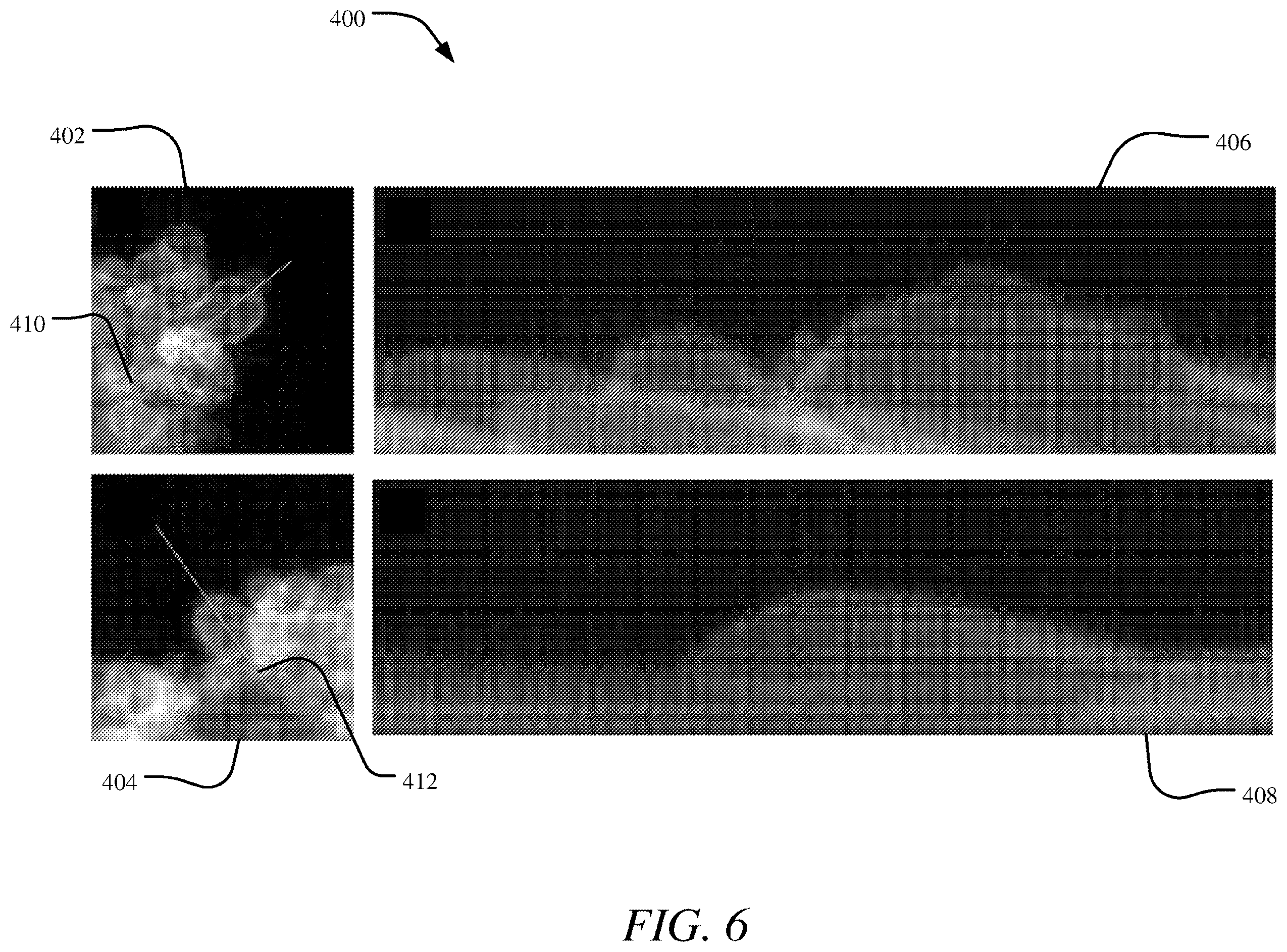 Patent US12366740 Figure 6 – Systems and methods for live projection imaging for fluorescence microscopy